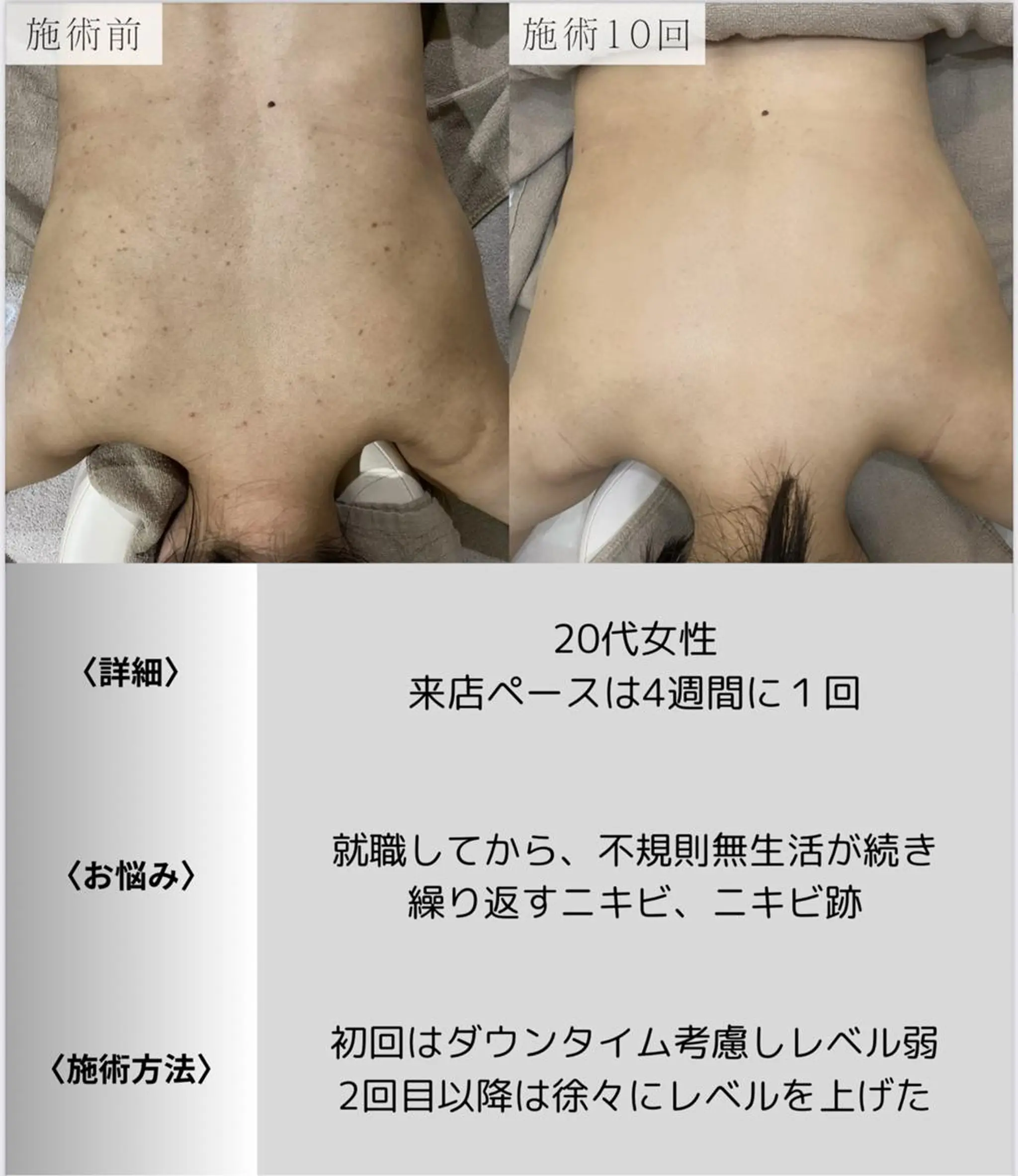 脱毛・眉毛・フェイス サロンN久留米店の眉毛・アイブロウイメージ