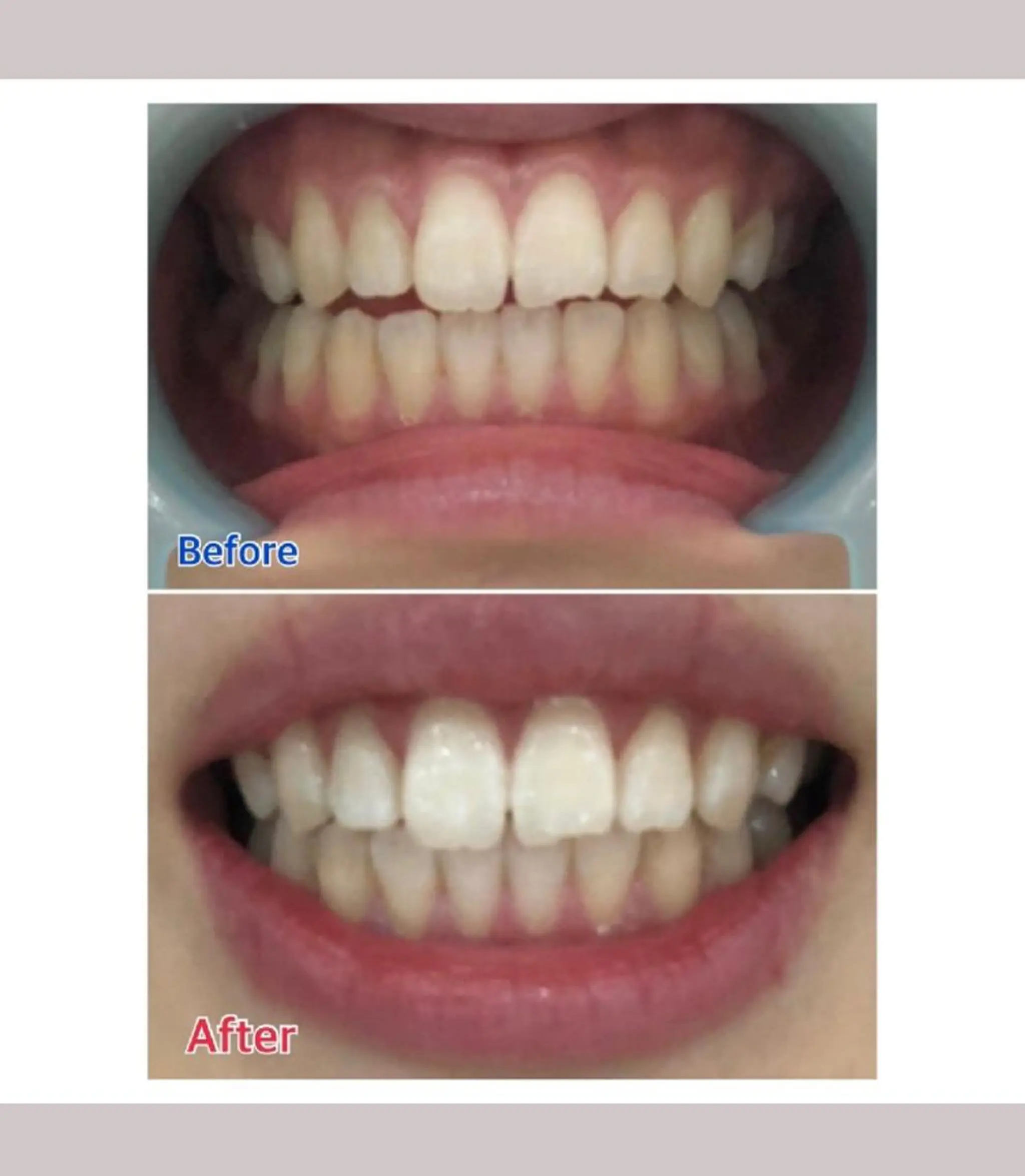 M渋谷 ホワイトニングのエステ・リラクイメージ