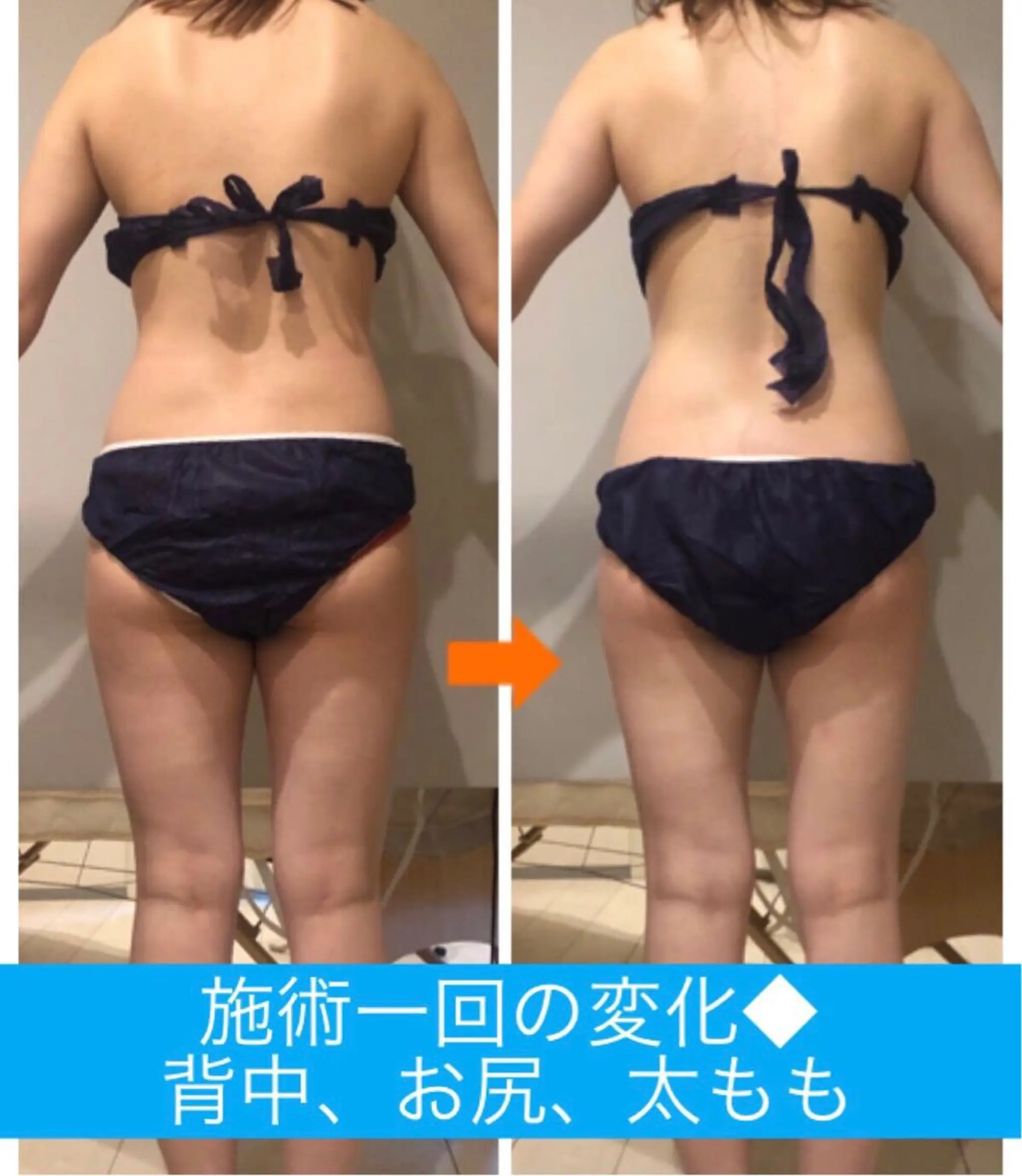 ショート カラー パーマ ヘアアレンジ メンズ キッズ ネイル マツエク・マツパ 痩身&ボディ 結果出し🌟丹野のエステ・リラクイメージ