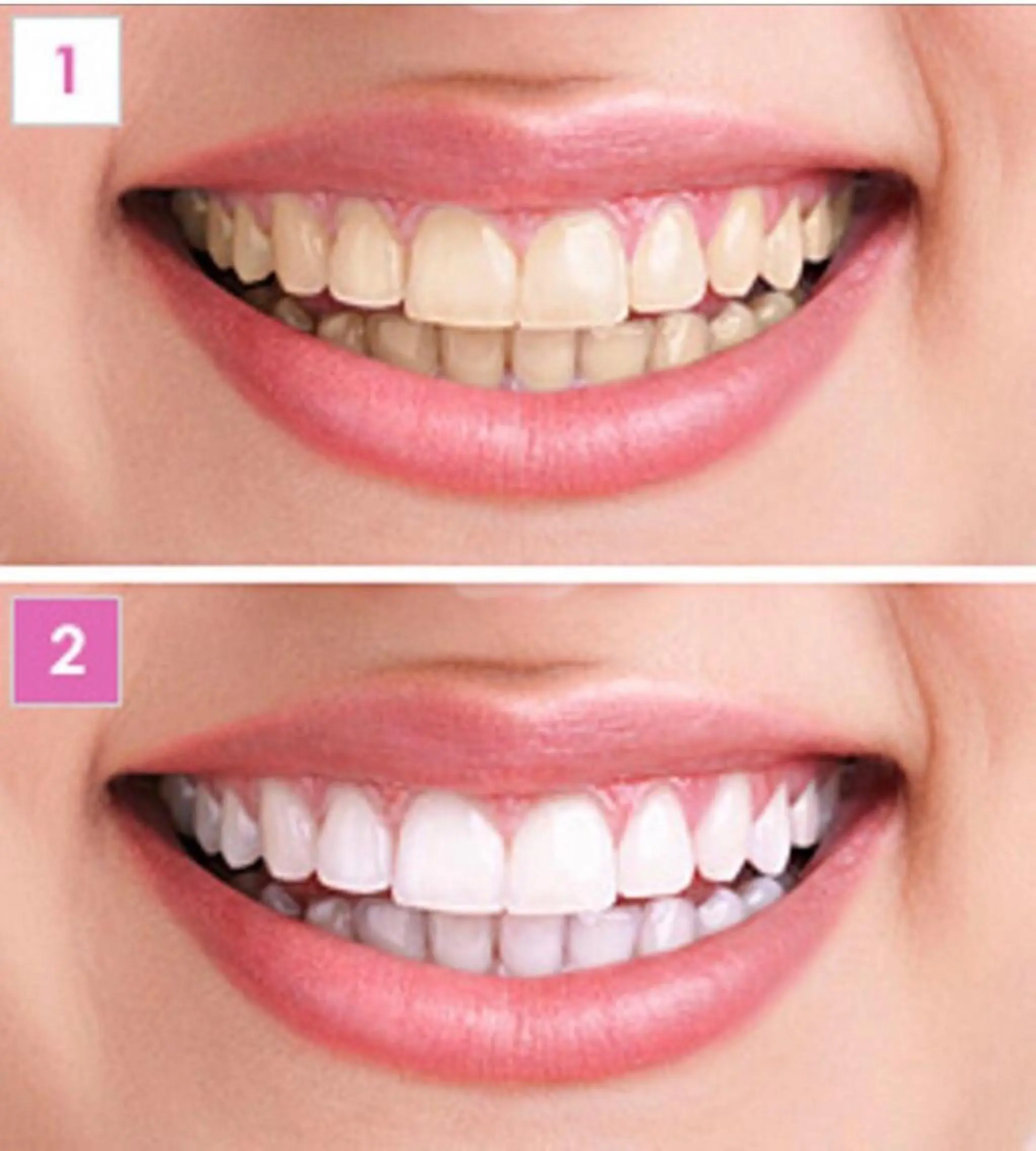 その他 vi viのヘアスタイル