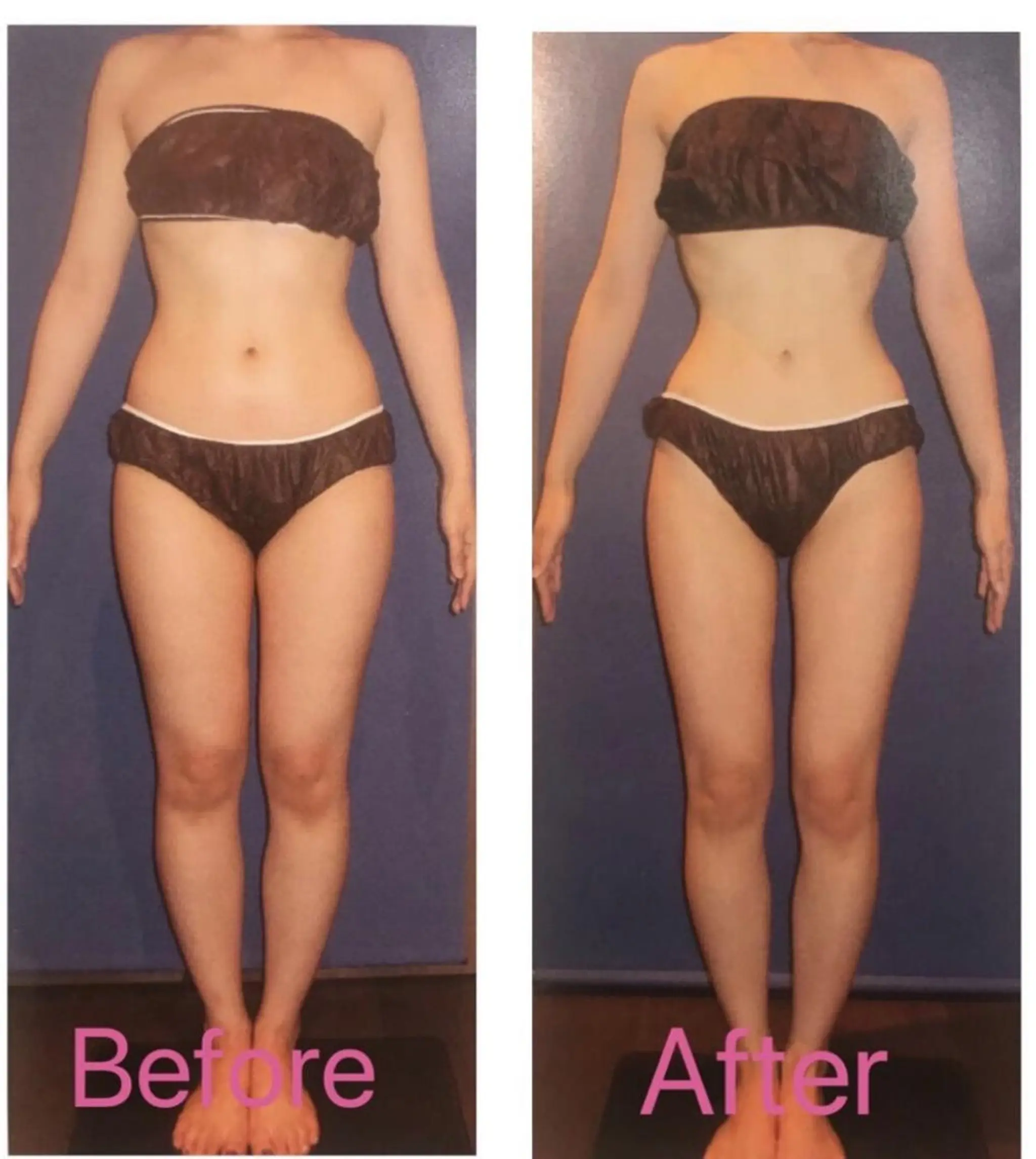 エステ BELINDA銀座店 ✨痩身エステサロン✨のエステ・リラクイメージ