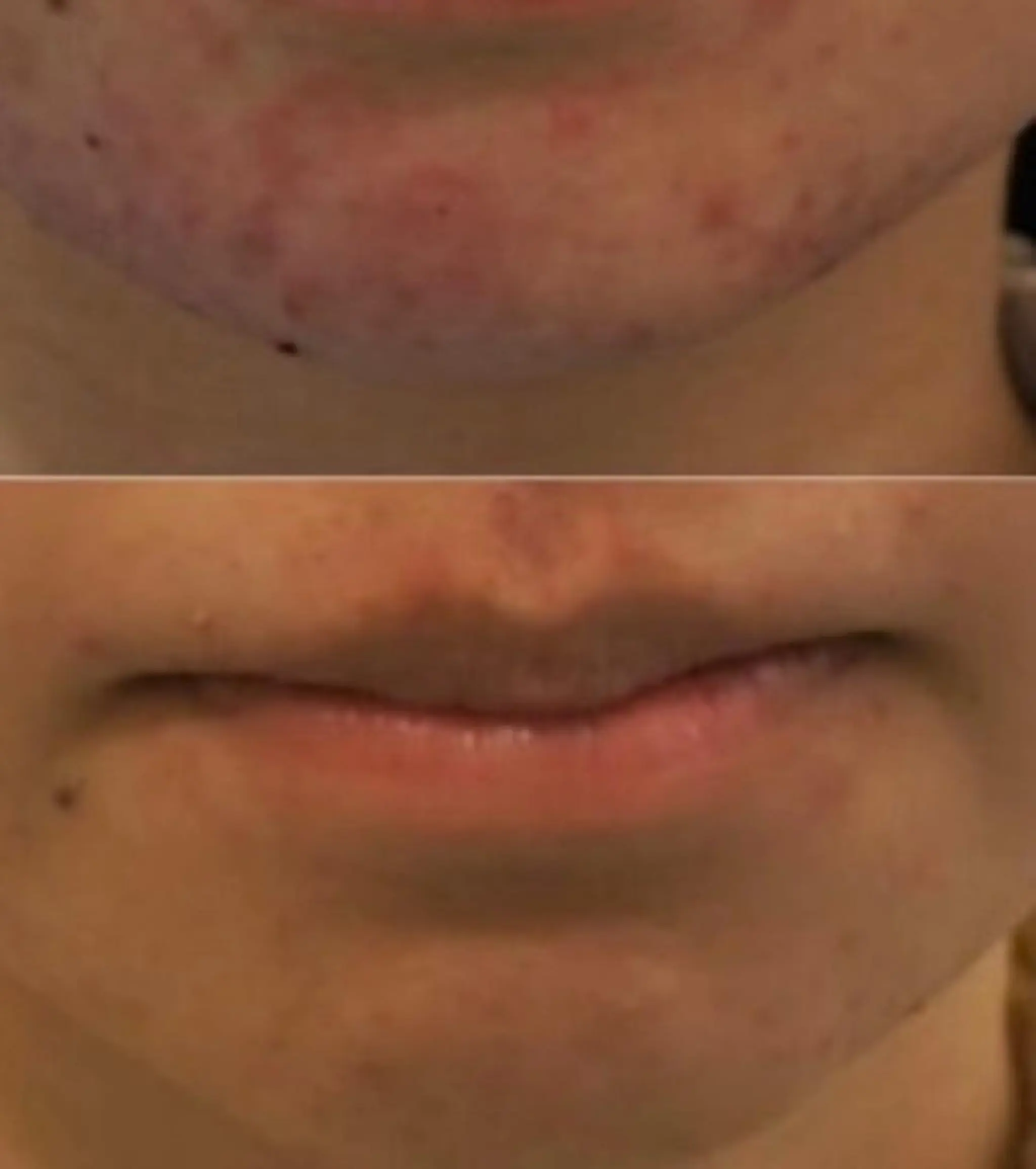 メンズ 朝重い人専用 肩甲骨調整のエステ・リラクイメージ