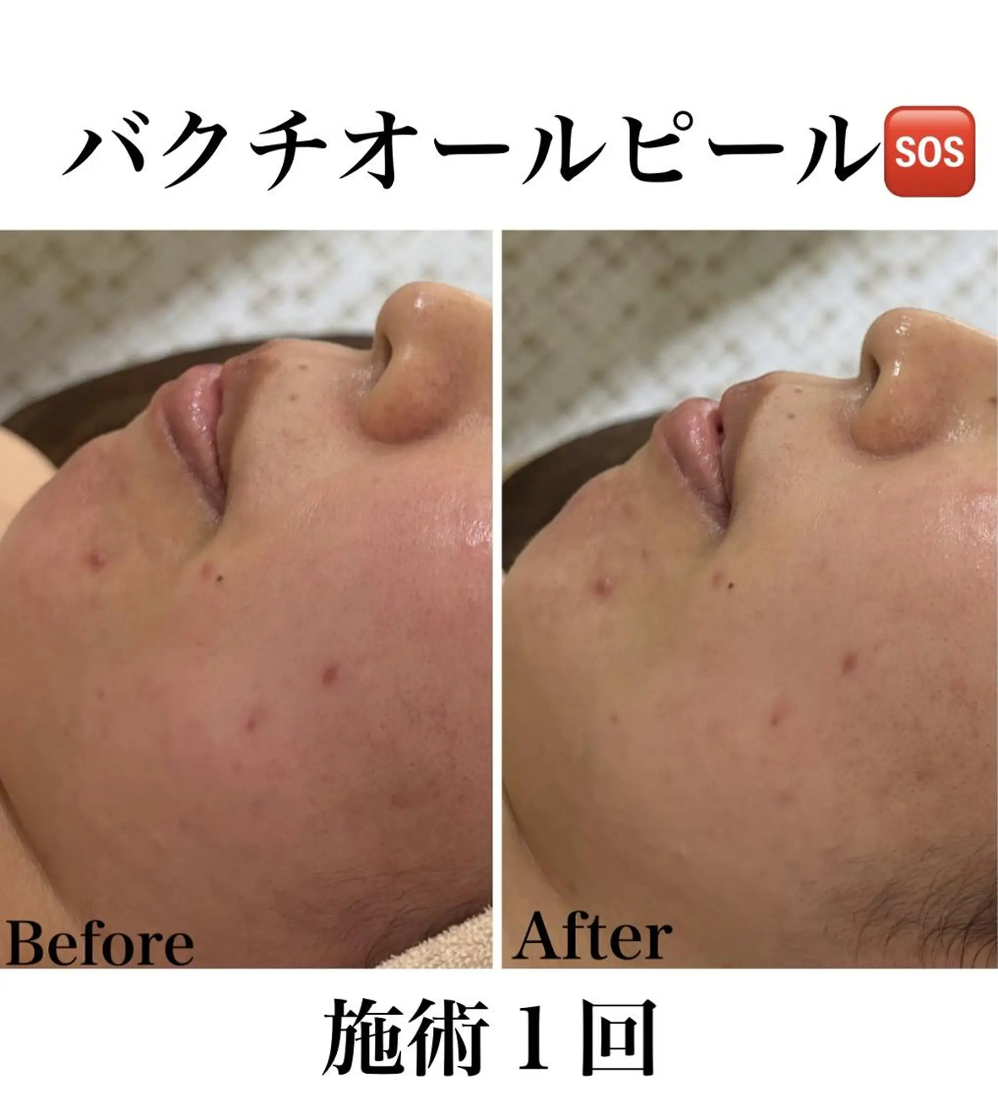 《美肌&小顔サロン》 Masqueradeのエステ・リラクイメージ