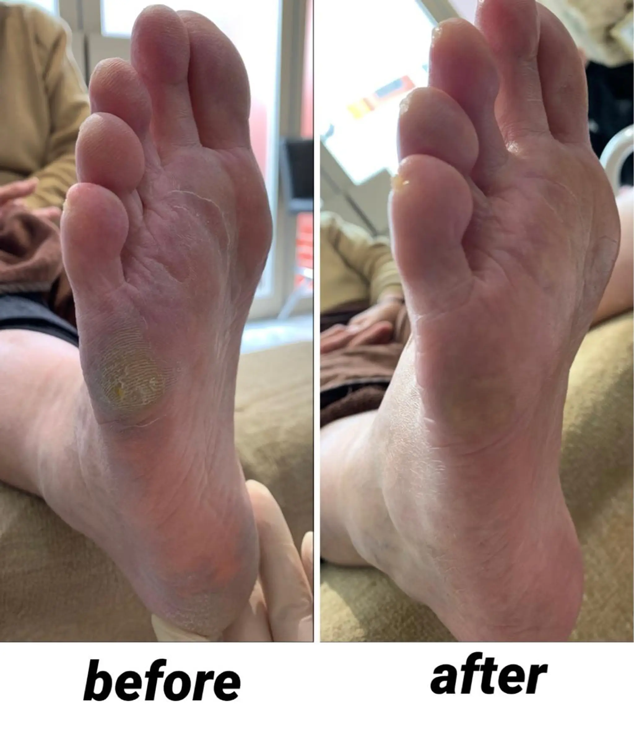 ネイル 毛穴改善/脱毛 ネイル　川上久仁子のエステ・リラクイメージ