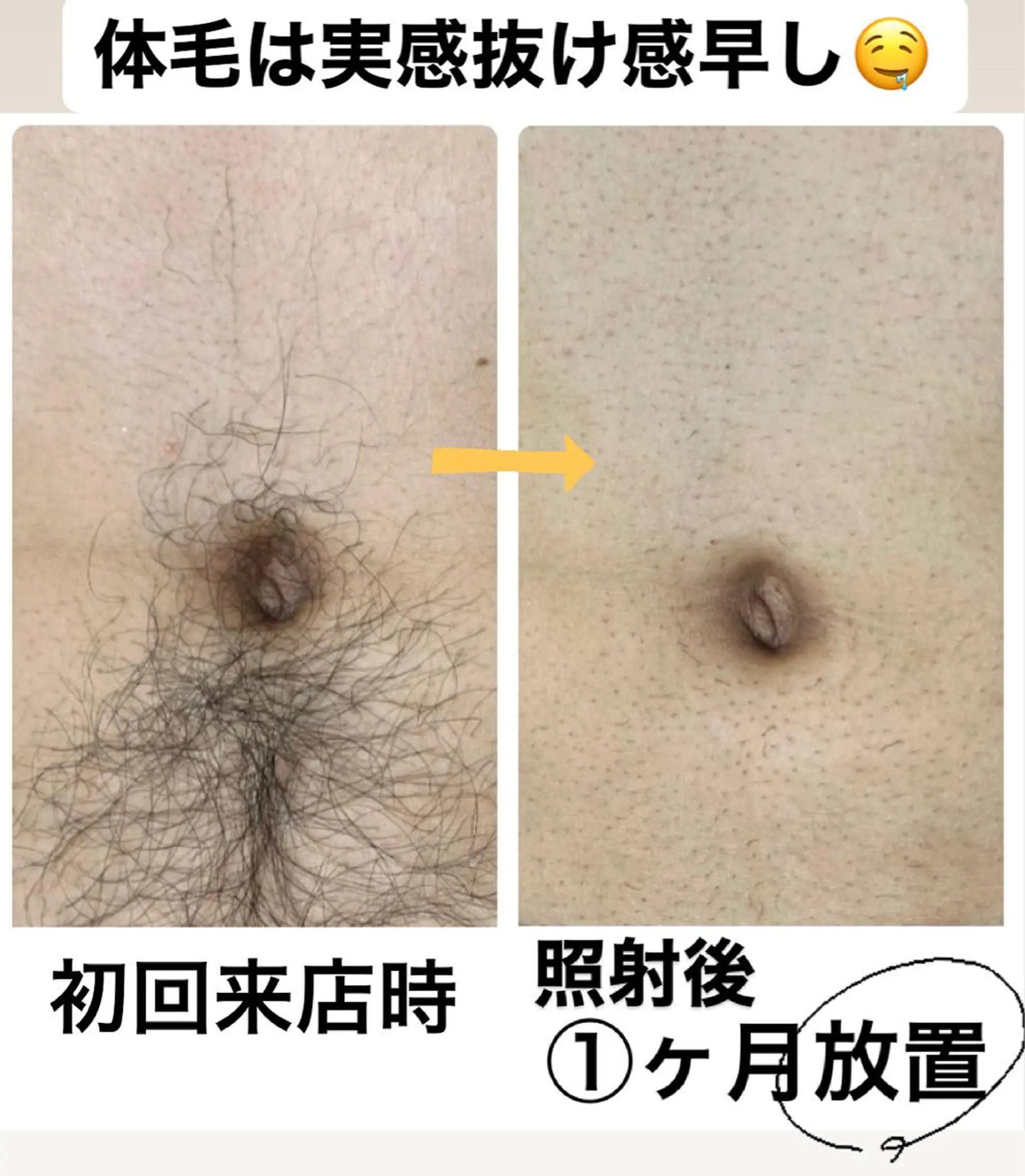 脱毛 メンズ脱毛サロン Le falcoのエステ・リラクイメージ