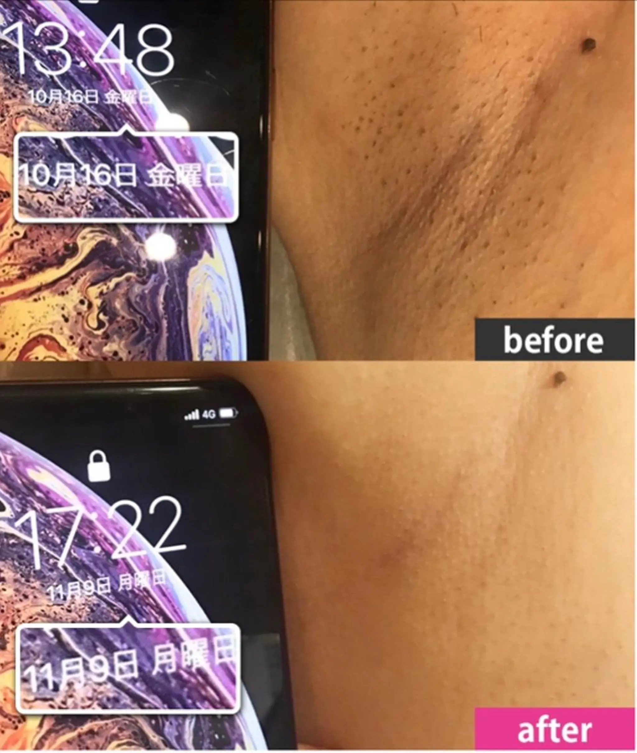 EfiNエフィン 青山店 小池のエステ・リラクイメージ