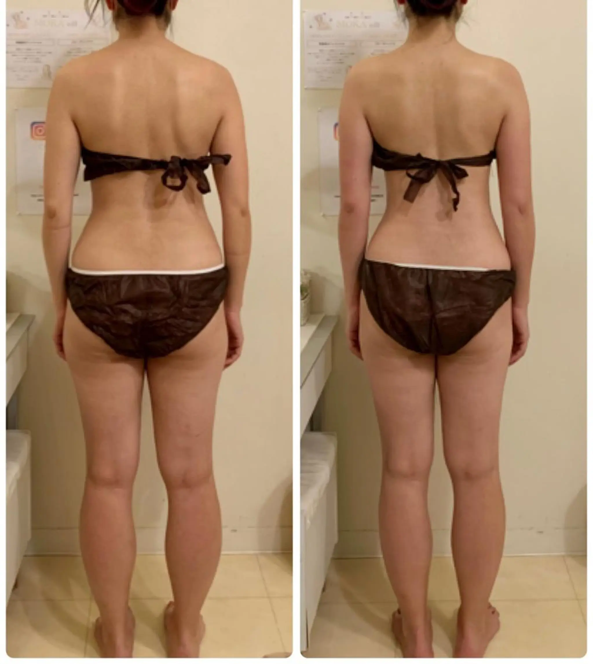 MOKA☆毒出し/ 毛穴/ブライダル専門のエステ・リラクイメージ