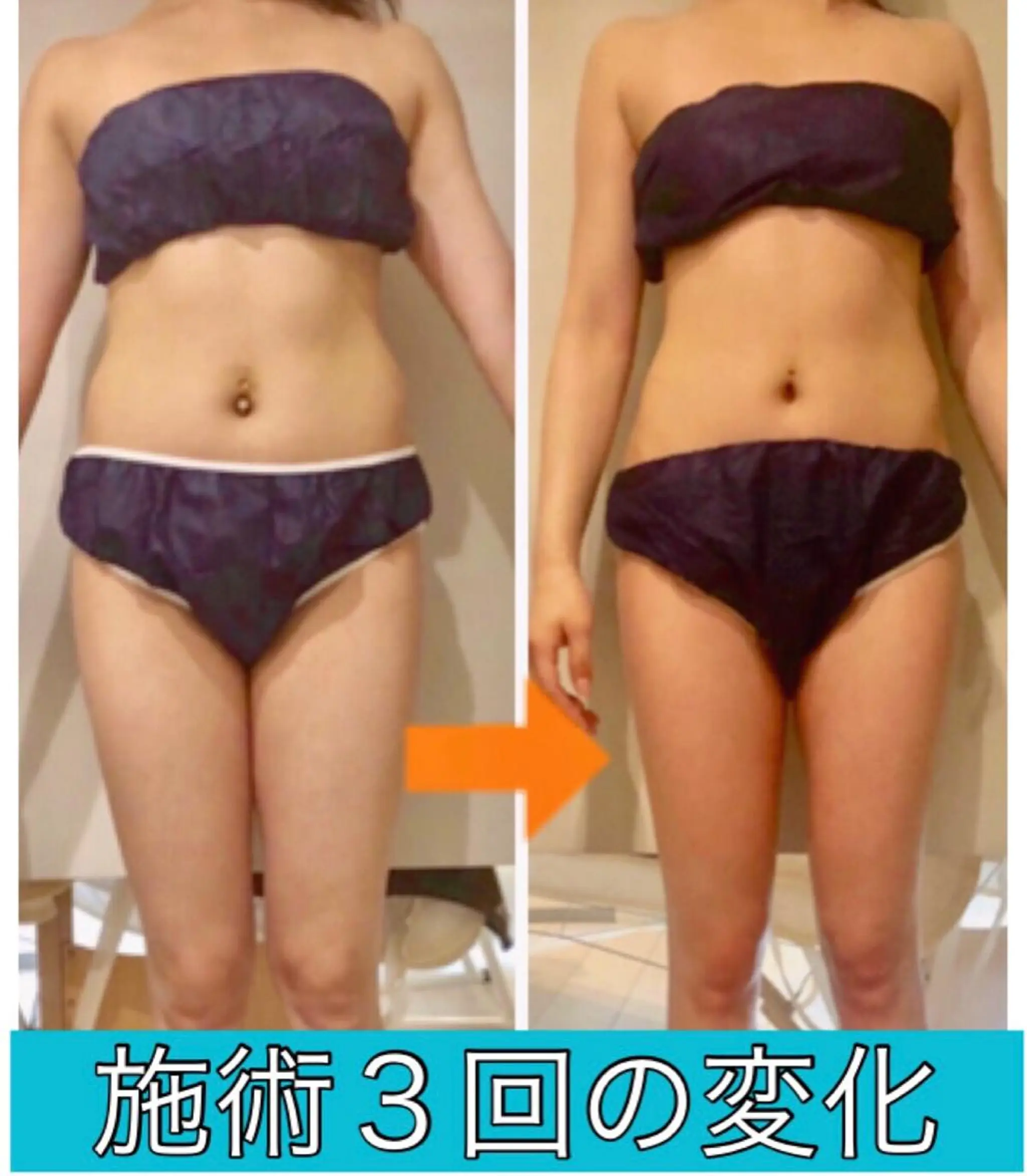 ショート カラー パーマ ヘアアレンジ メンズ キッズ ネイル マツエク・マツパ マットネイル ‍痩身＆ボディ 結果出し🌟丹野のエステ・リラクイメージ