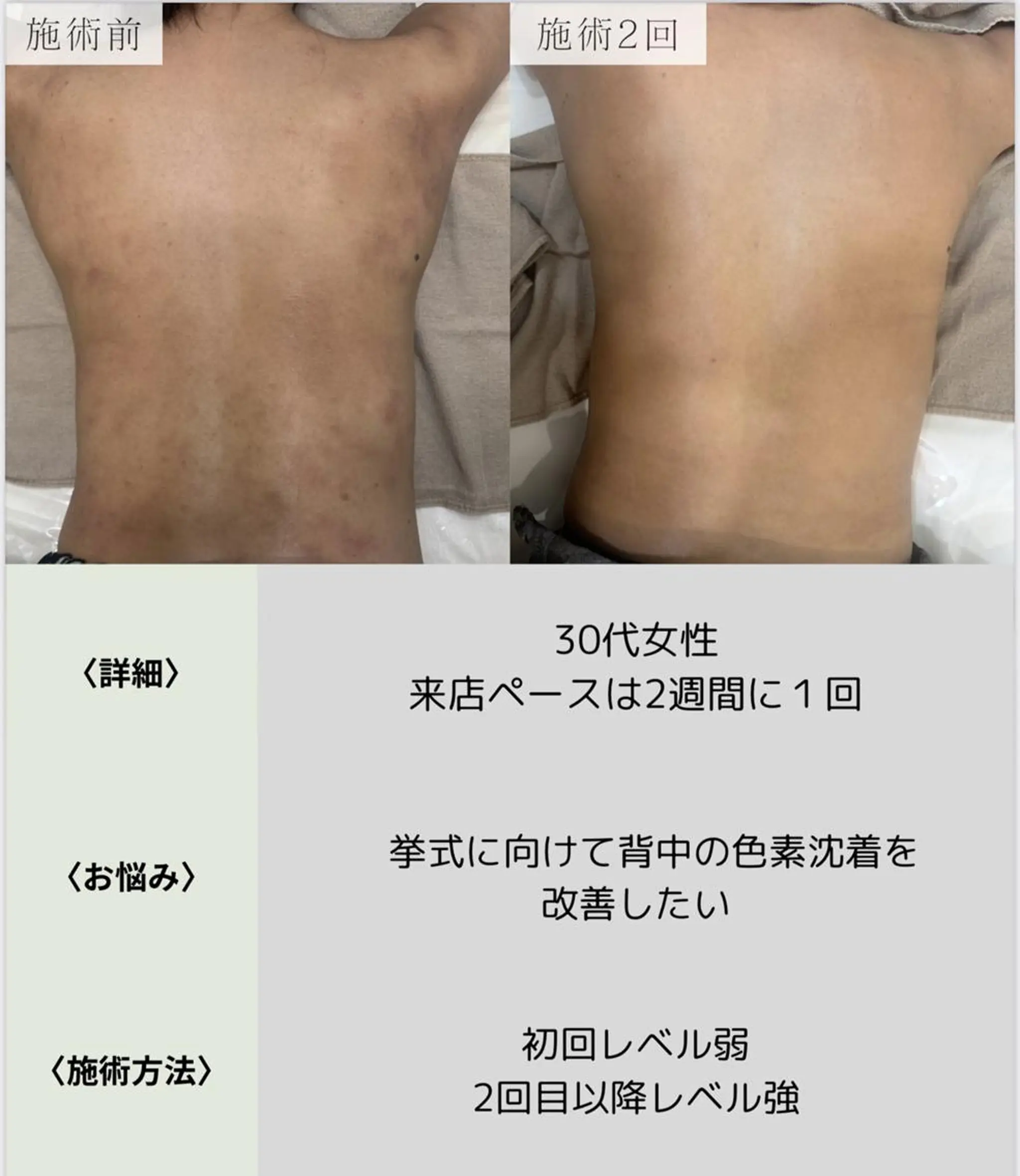 脱毛・眉毛・フェイス サロンN久留米店の眉毛・アイブロウイメージ