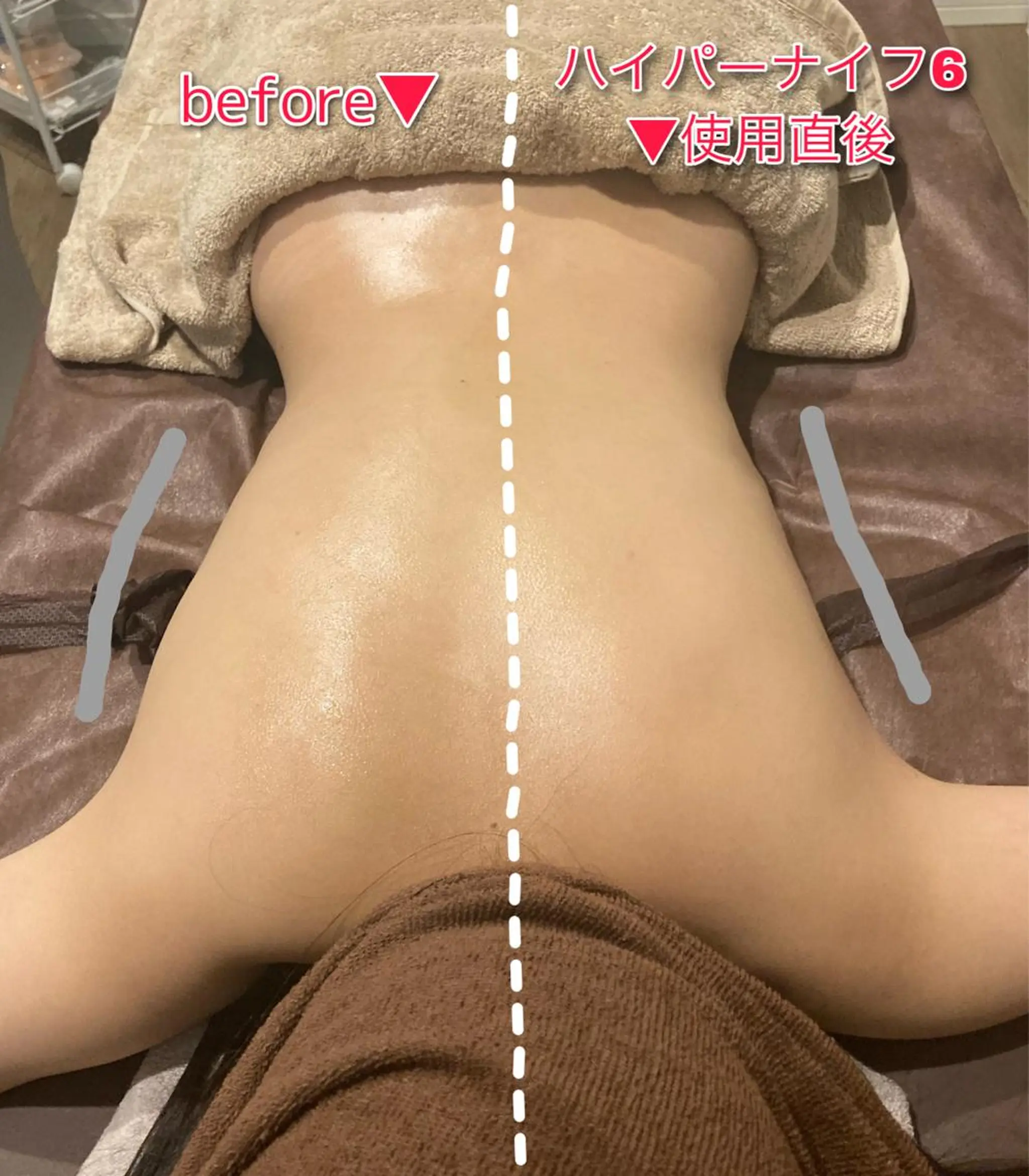 エステ リラク 痩身サロンiBDY所属・いわきり ゆきのエステ・リラクイメージ