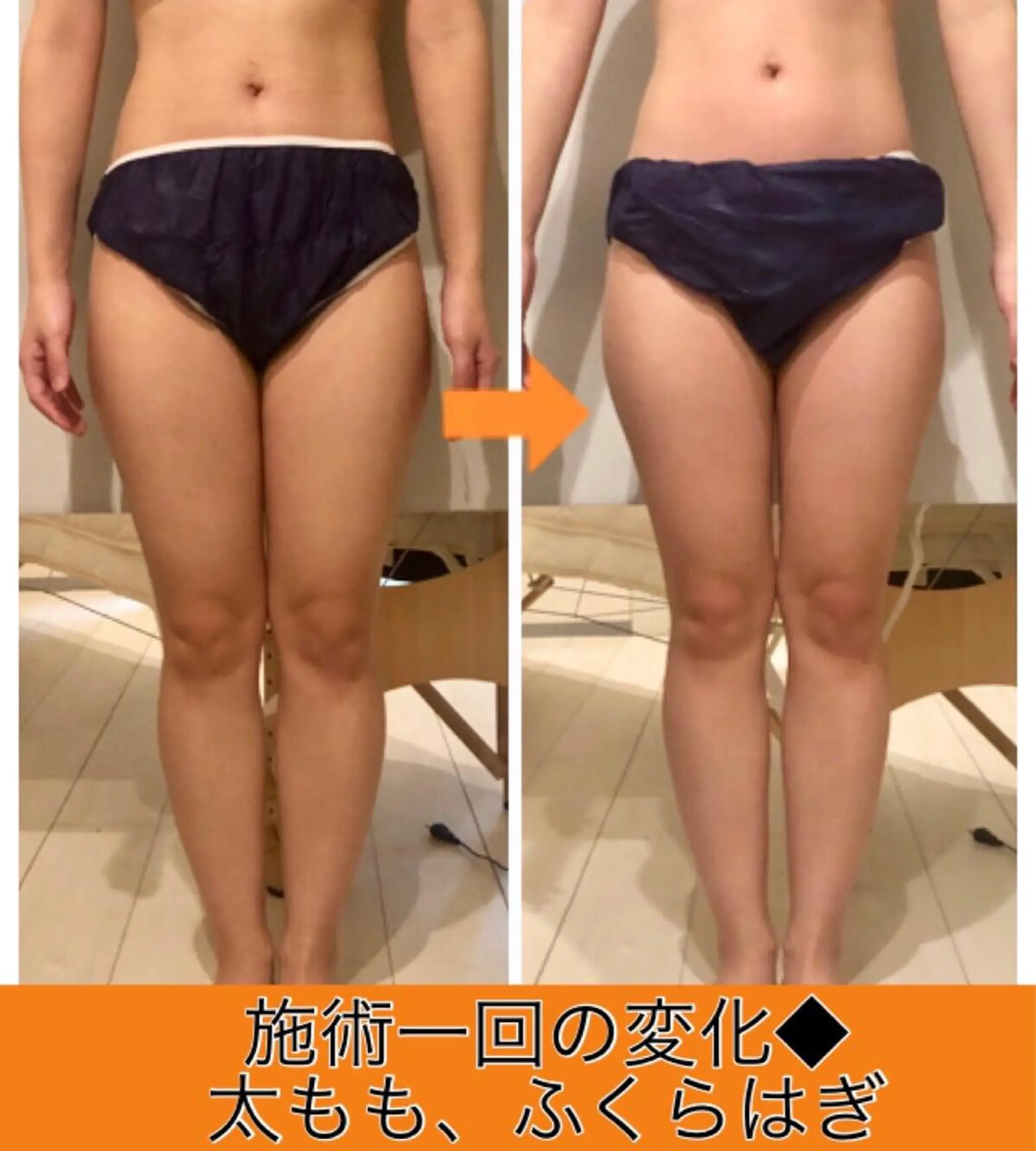 ロング カラー パーマ ヘアアレンジ メンズ キッズ ネイル マツエク・マツパ ‍痩身＆ボディ 結果出し🌟丹野のエステ・リラクイメージ