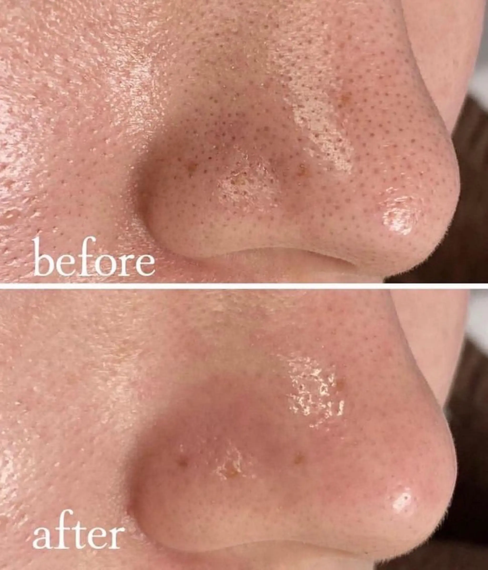 韓国肌管理 【毛穴専科】のエステ・リラクイメージ