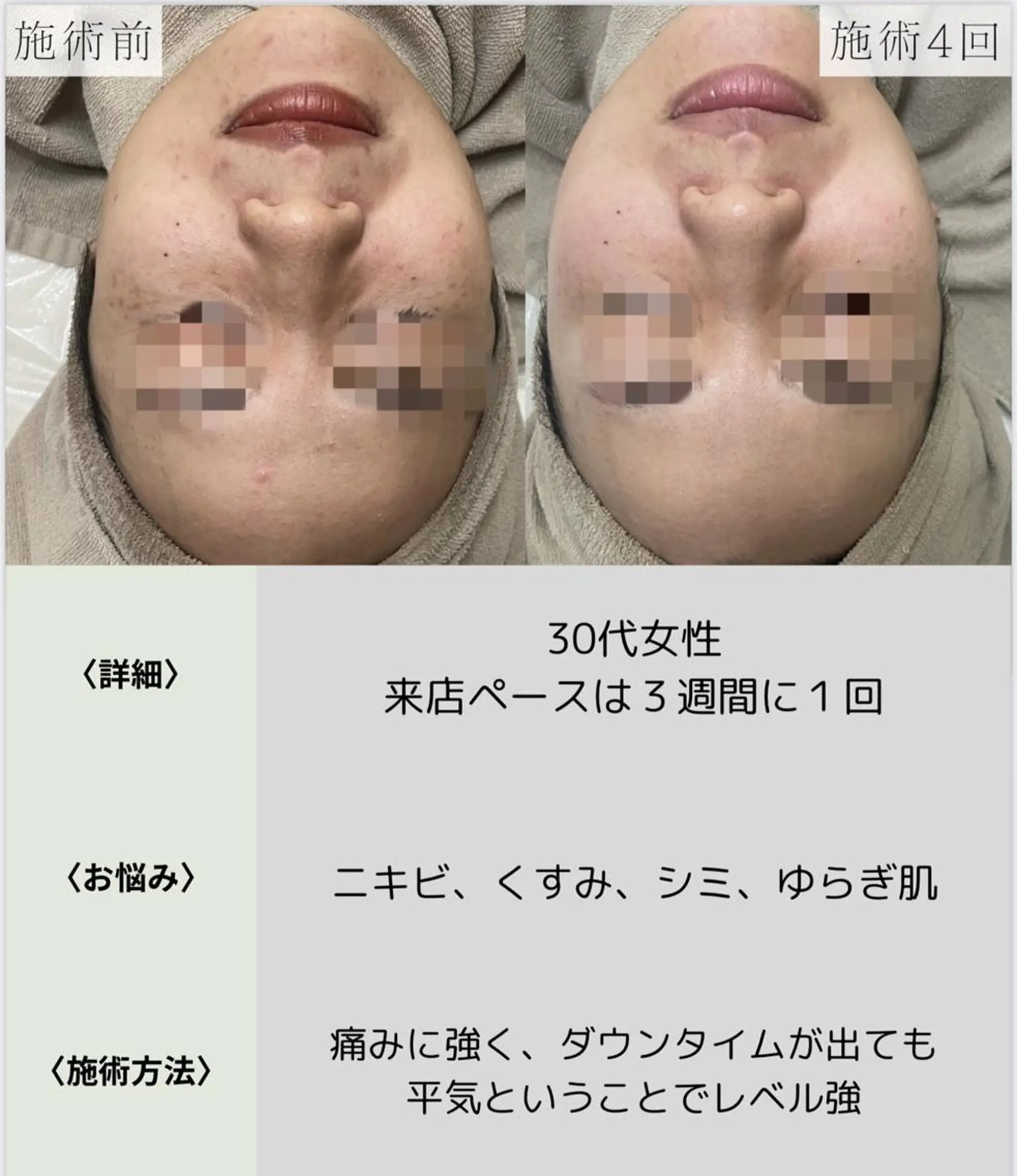 脱毛・眉毛・フェイス サロンN久留米店の眉毛・アイブロウイメージ