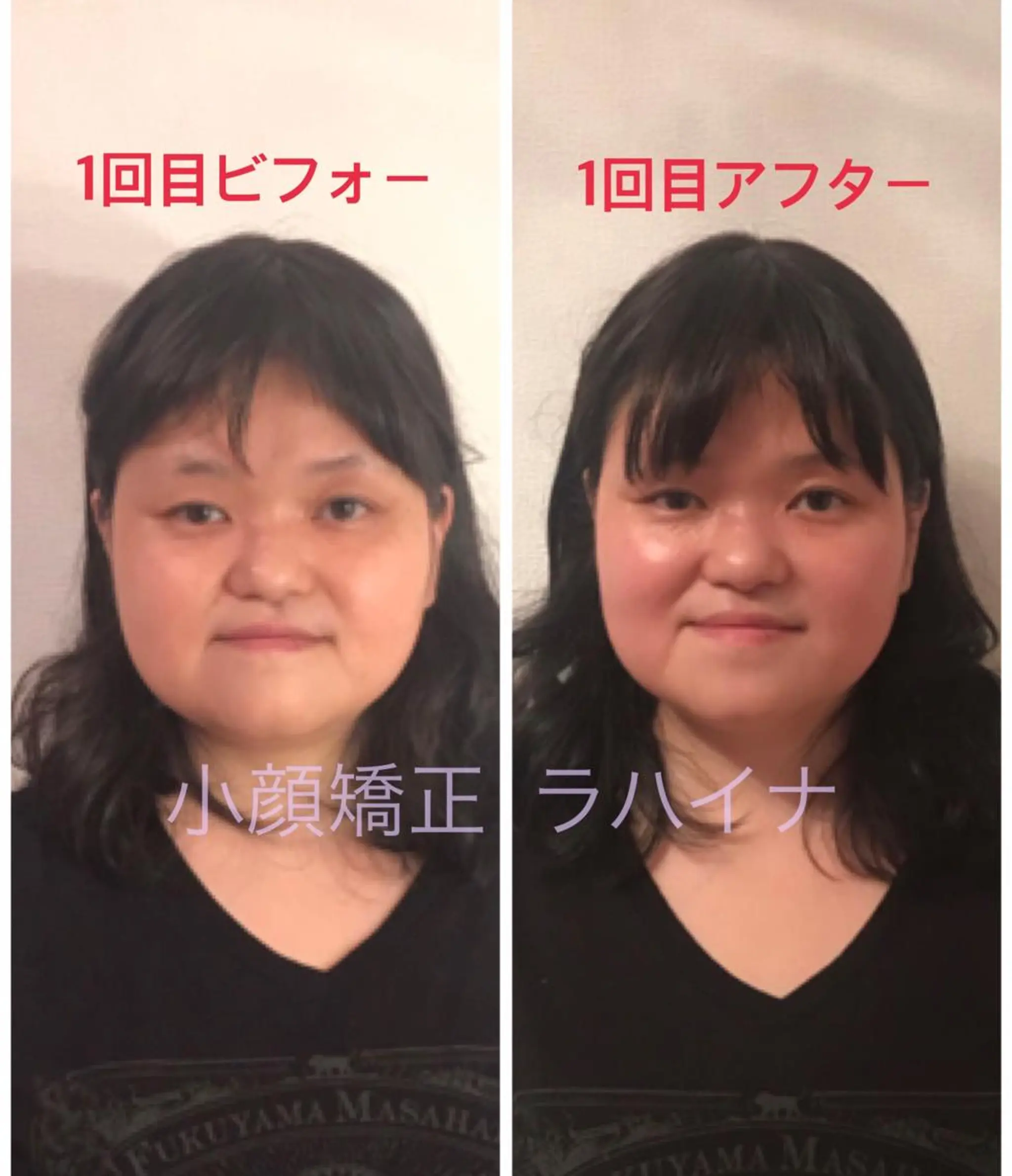 エステ リラク 小顔矯正 ラハイナのエステ・リラクイメージ