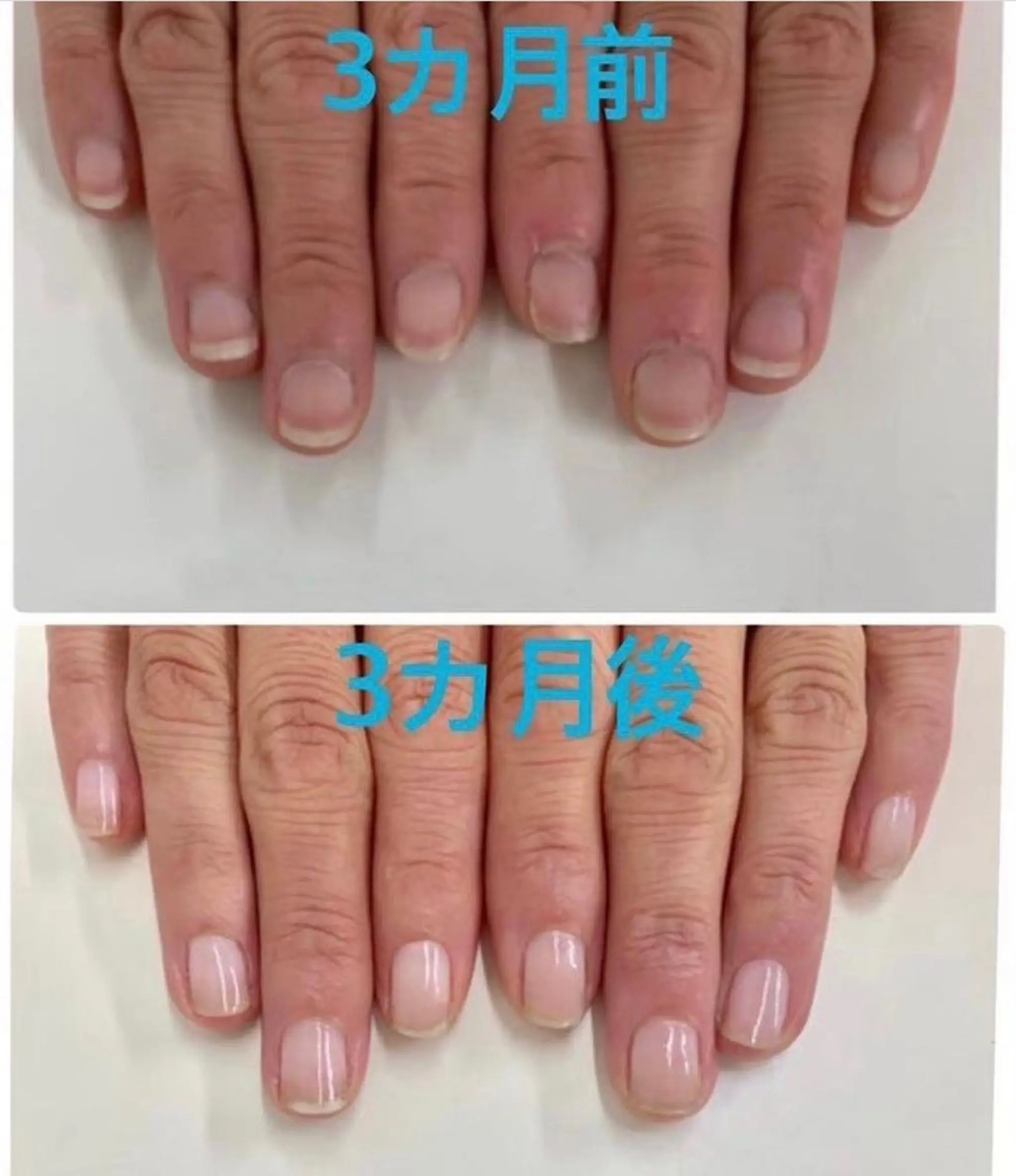 ネイル 久場 晴美のネイルデザイン