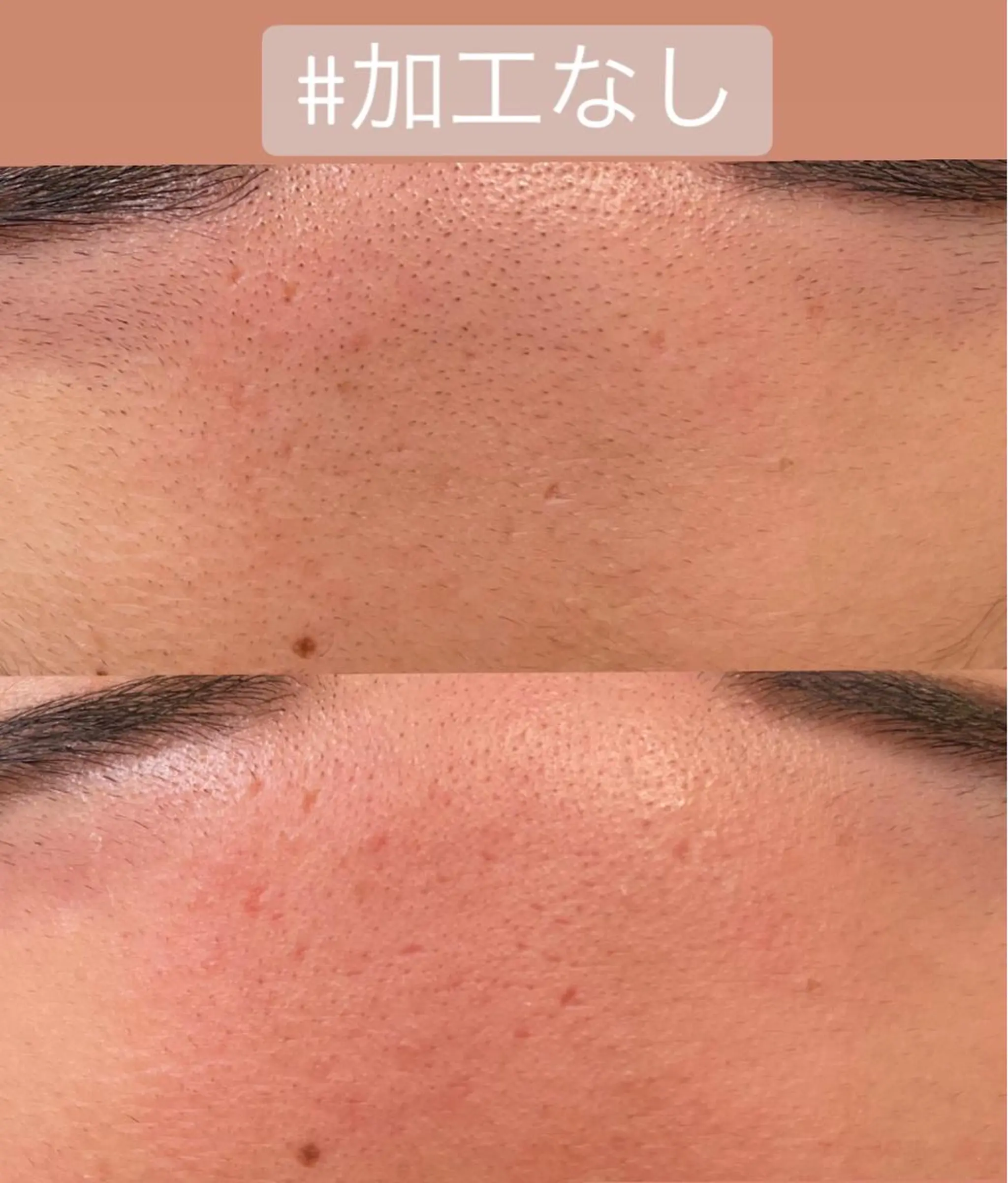 脱毛 森崎 麗のマツエク・マツパデザイン