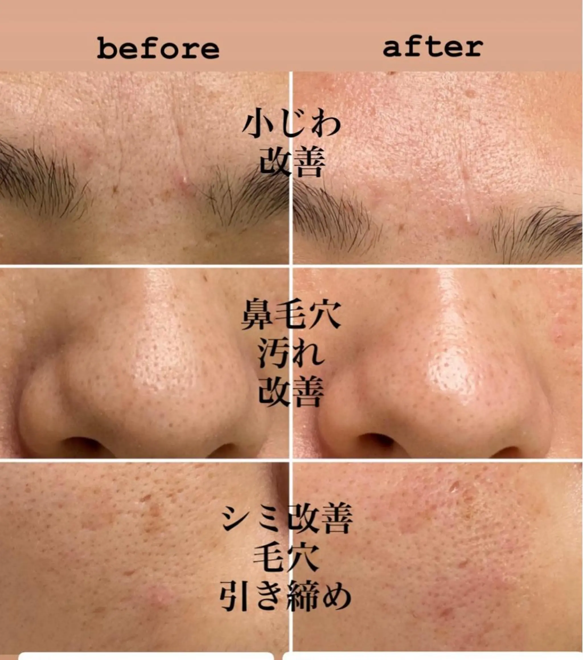 エステ Raffoler りさのエステ・リラクイメージ