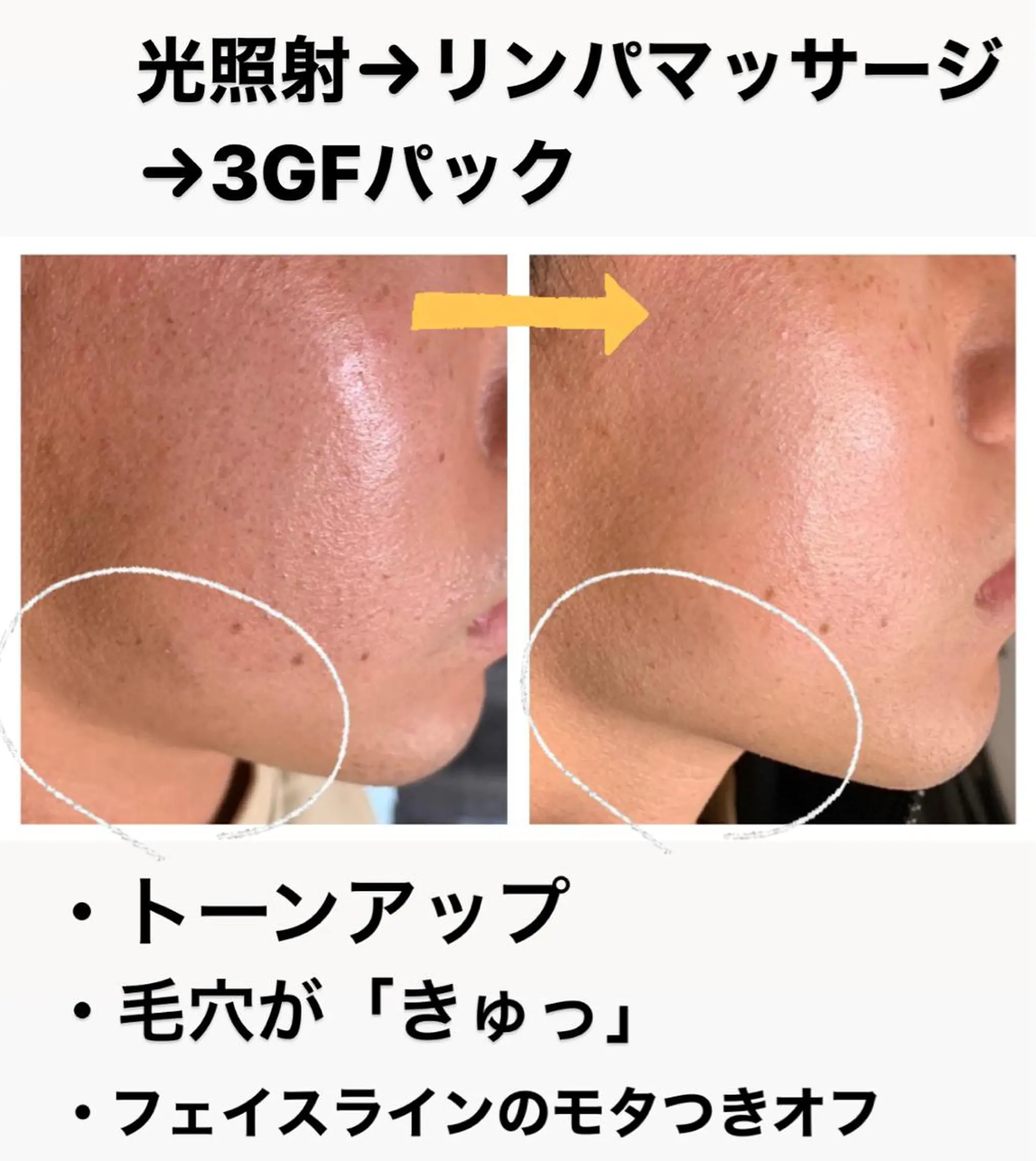 エステ リラク メンズ脱毛サロン Le falcoのエステ・リラクイメージ