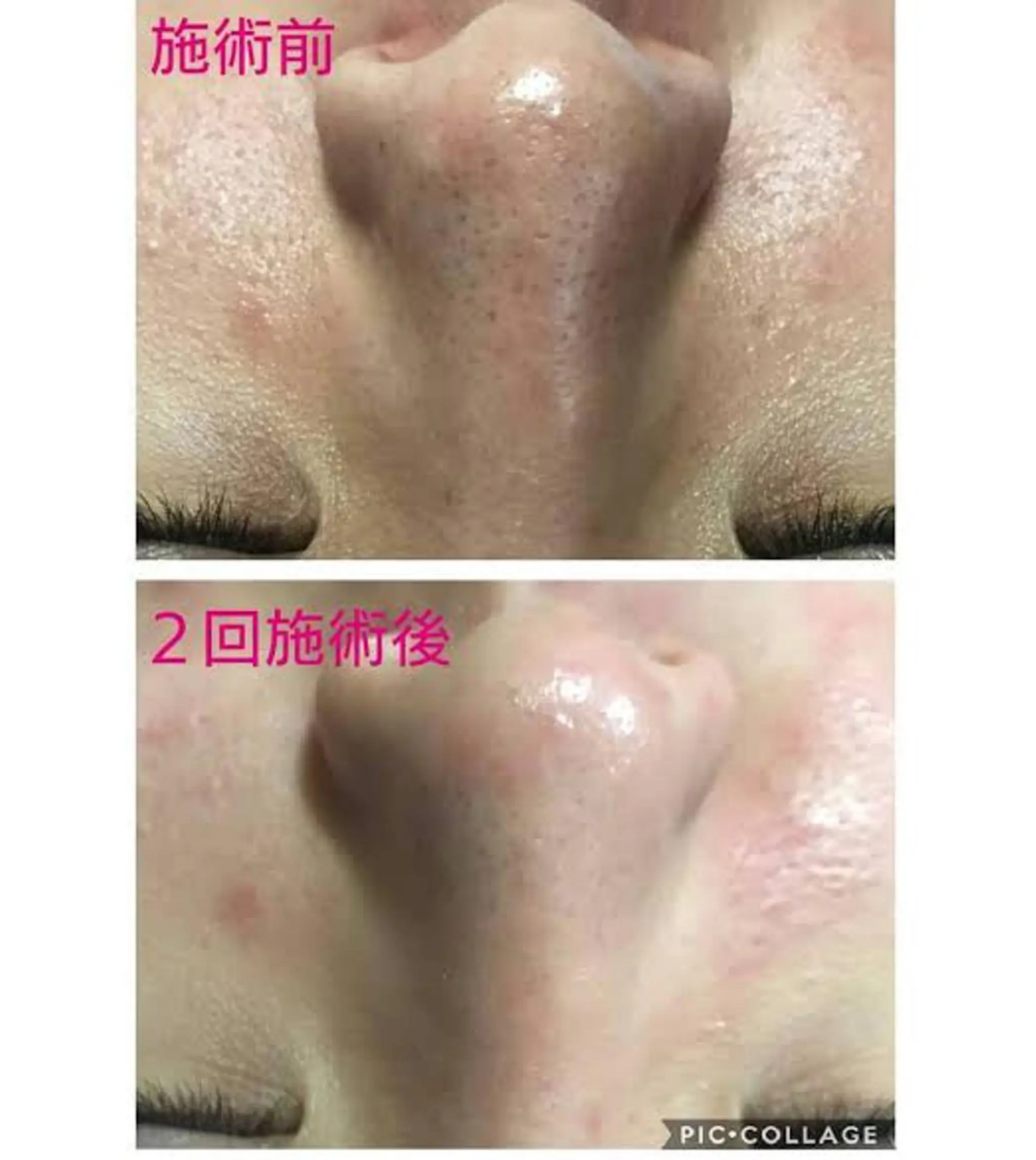 脱毛＆肌質改善サロン shandeelのエステ・リラクイメージ