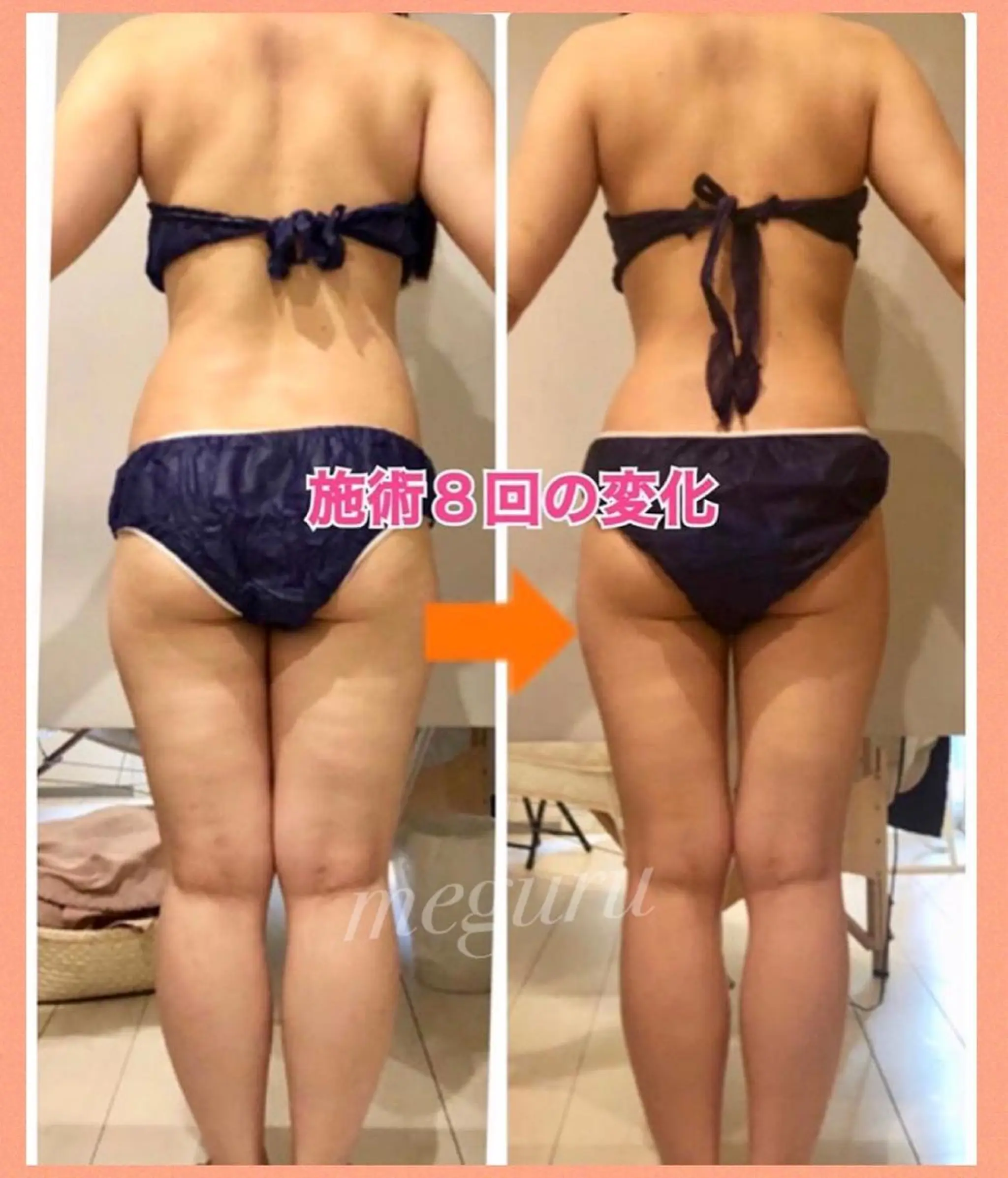 ショート カラー パーマ ヘアアレンジ メンズ キッズ ネイル マツエク・マツパ エステ リラク ‍痩身＆ボディ 結果出し🌟丹野のエステ・リラクイメージ