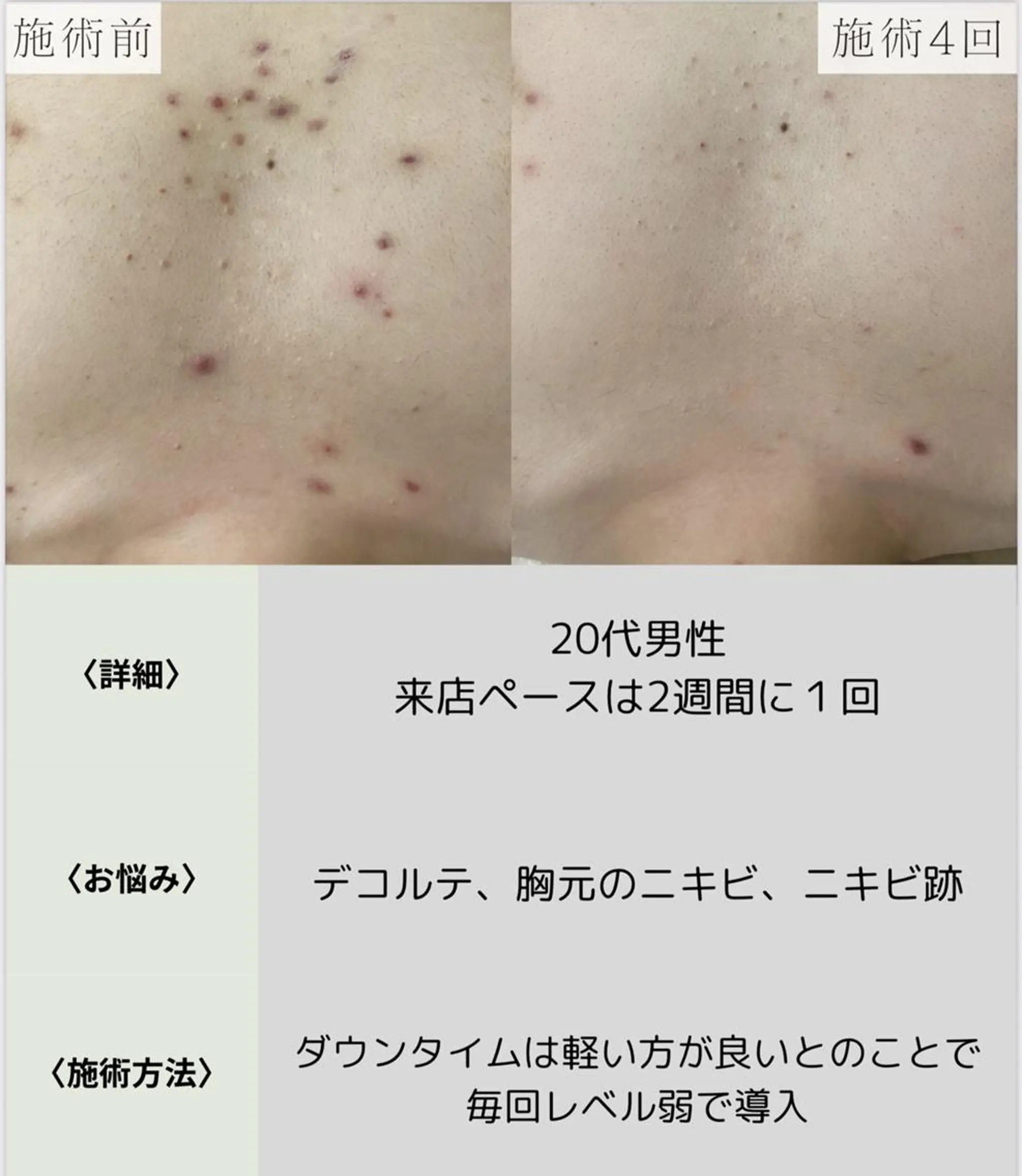 脱毛・眉毛・フェイス サロンN久留米店の眉毛・アイブロウイメージ