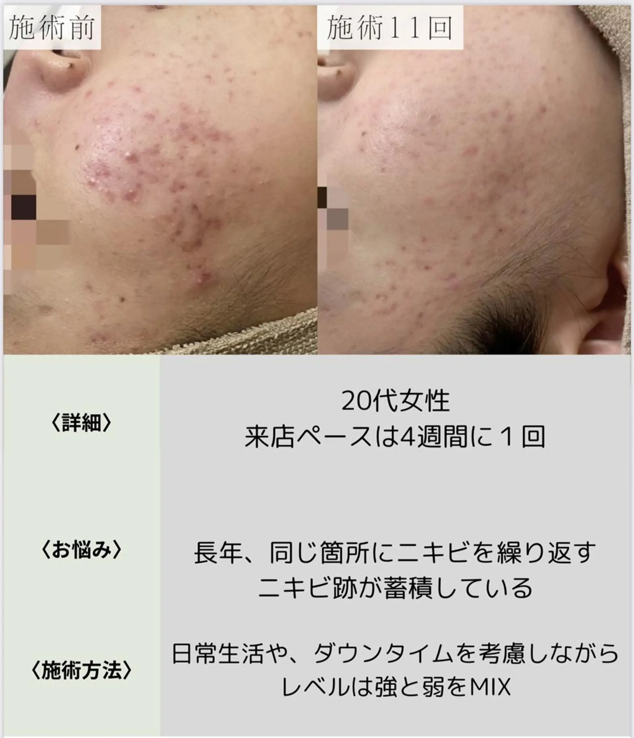 脱毛・眉毛・フェイス サロンN久留米店の眉毛・アイブロウイメージ