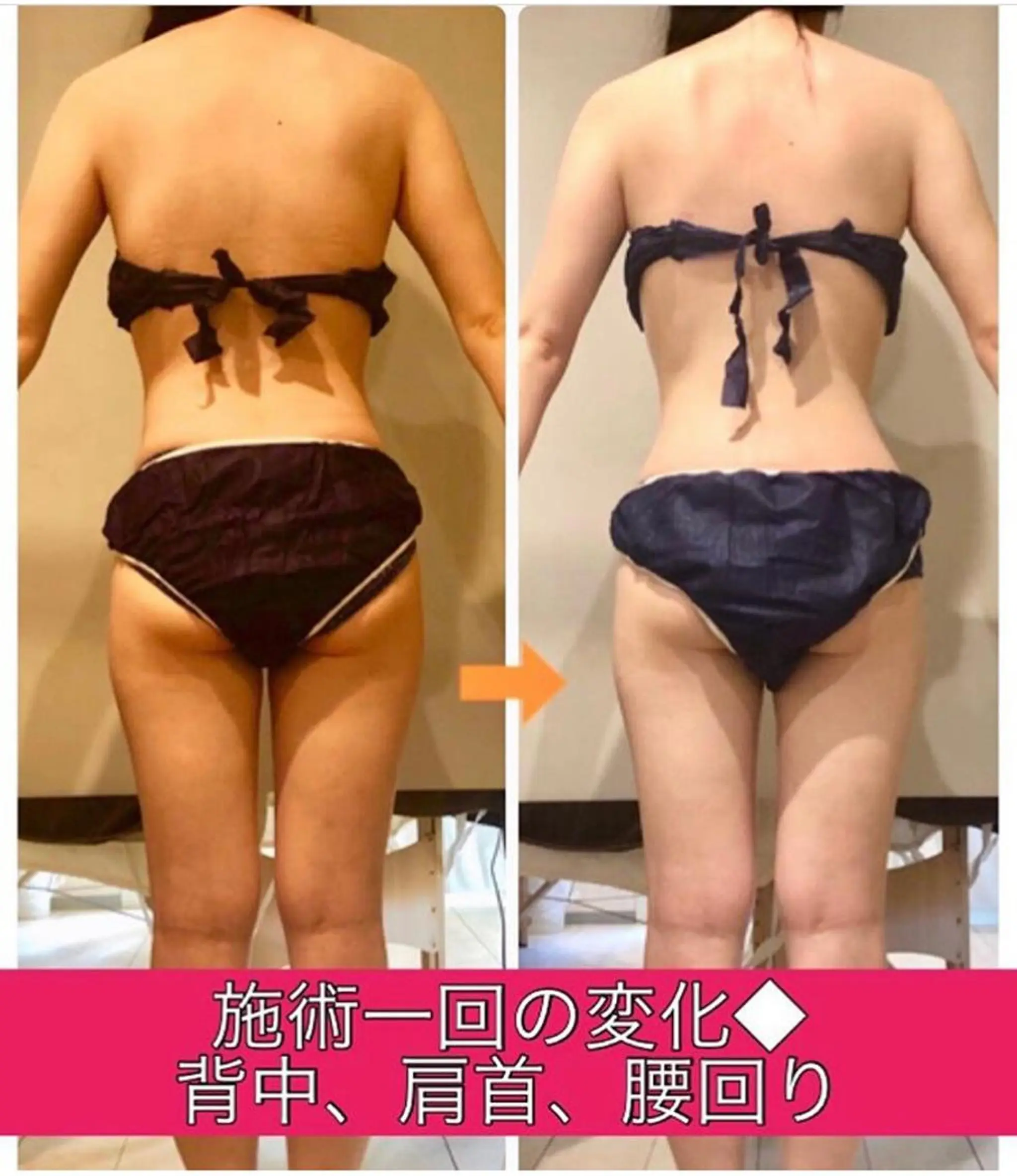 ロング カラー パーマ ヘアアレンジ メンズ キッズ ネイル マツエク・マツパ ‍痩身＆ボディ 結果出し🌟丹野のエステ・リラクイメージ