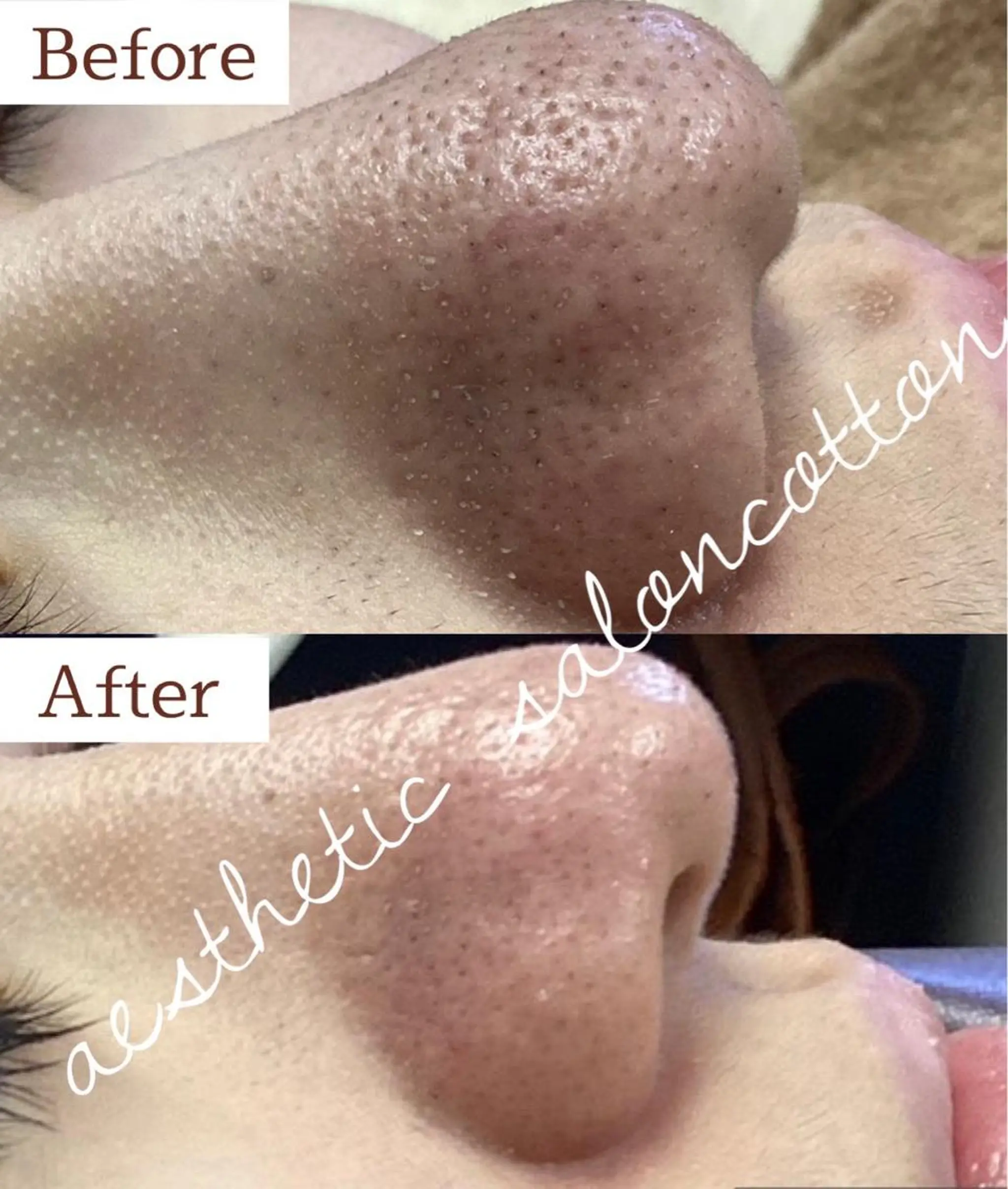 エステ 都度払い 肌質改善専門サロンのエステ・リラクイメージ