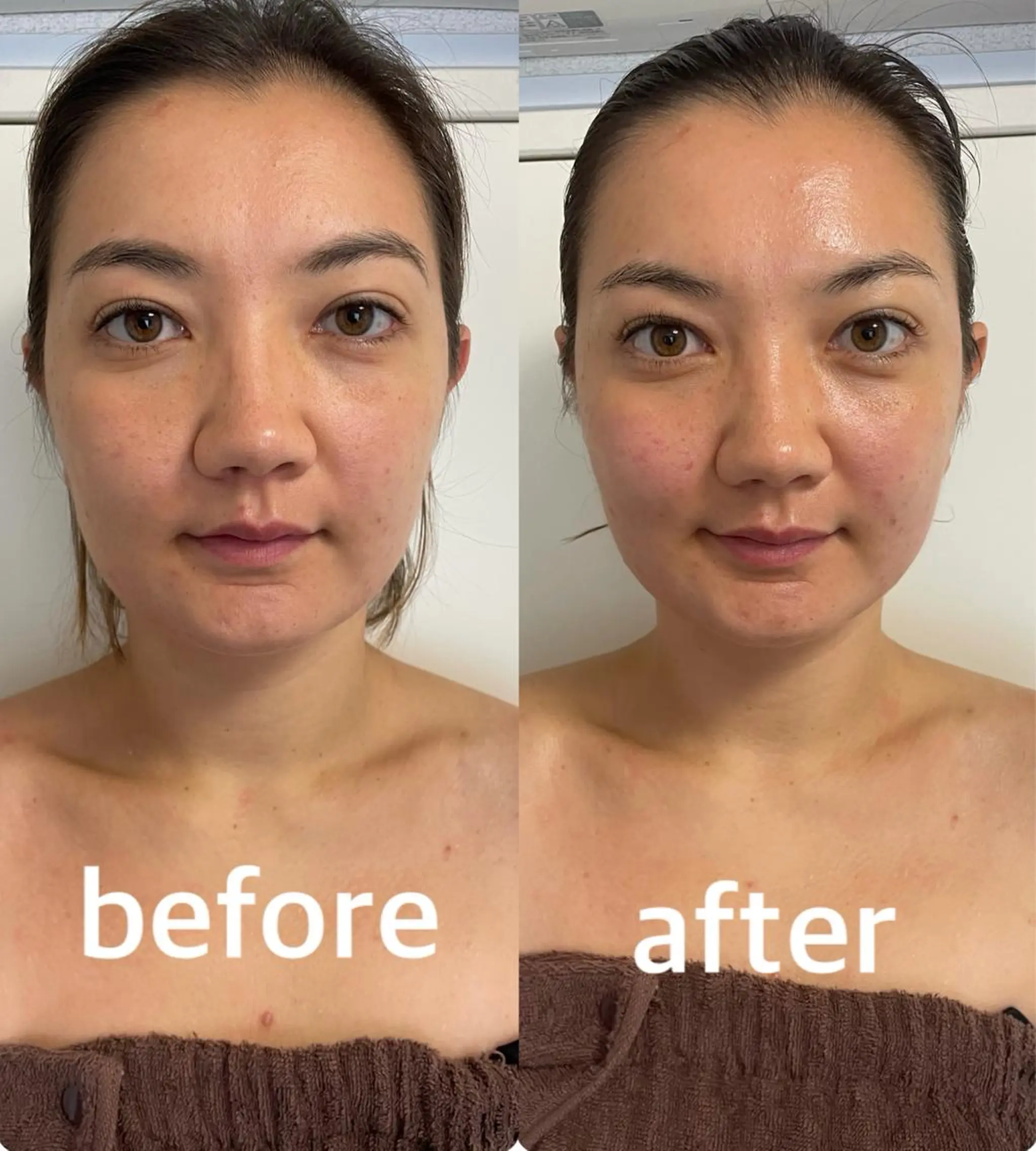 美容鍼灸サロン mahoroba院長のエステ・リラクイメージ