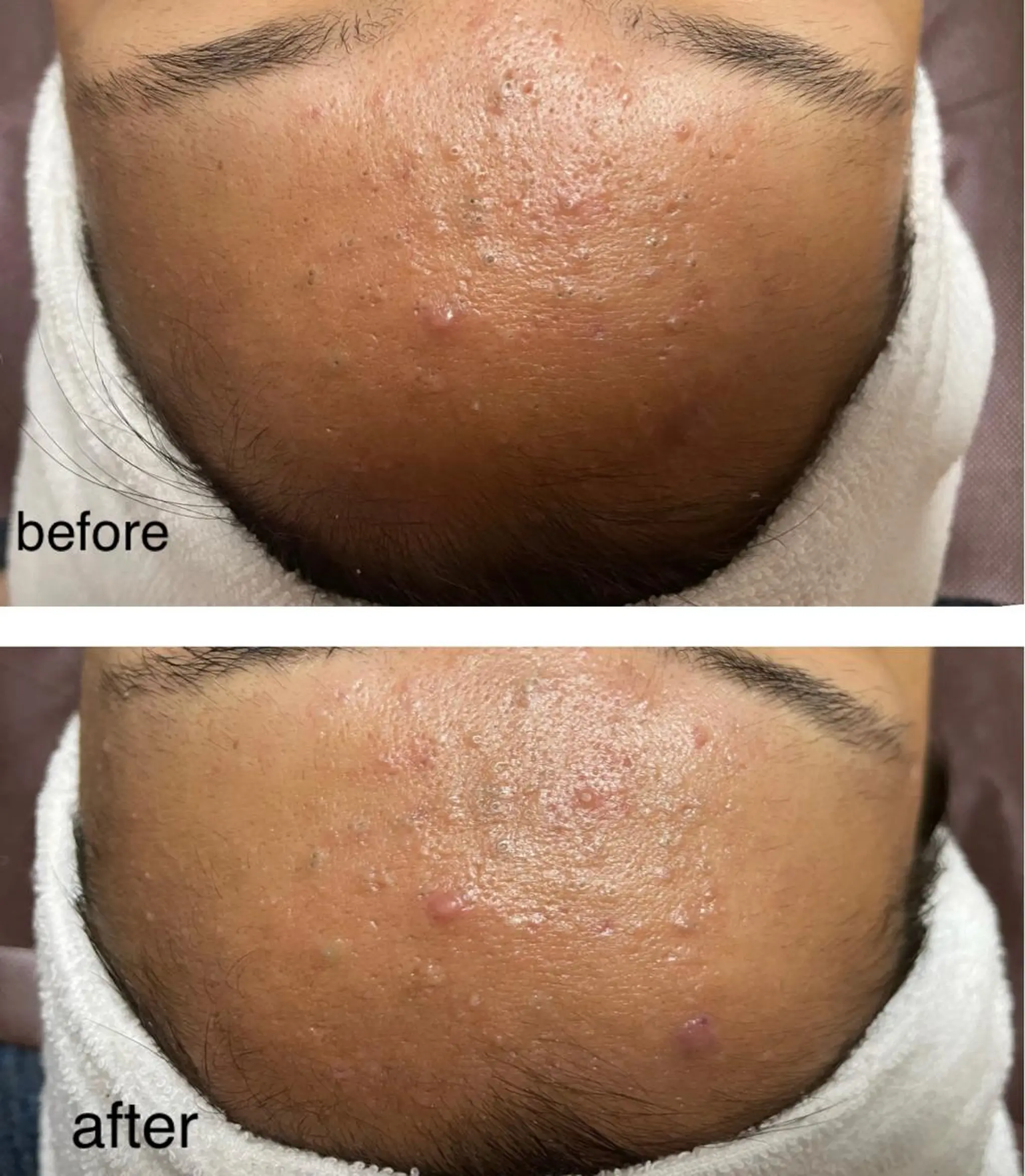 ビューティーサロン B.glossyのネイルデザイン