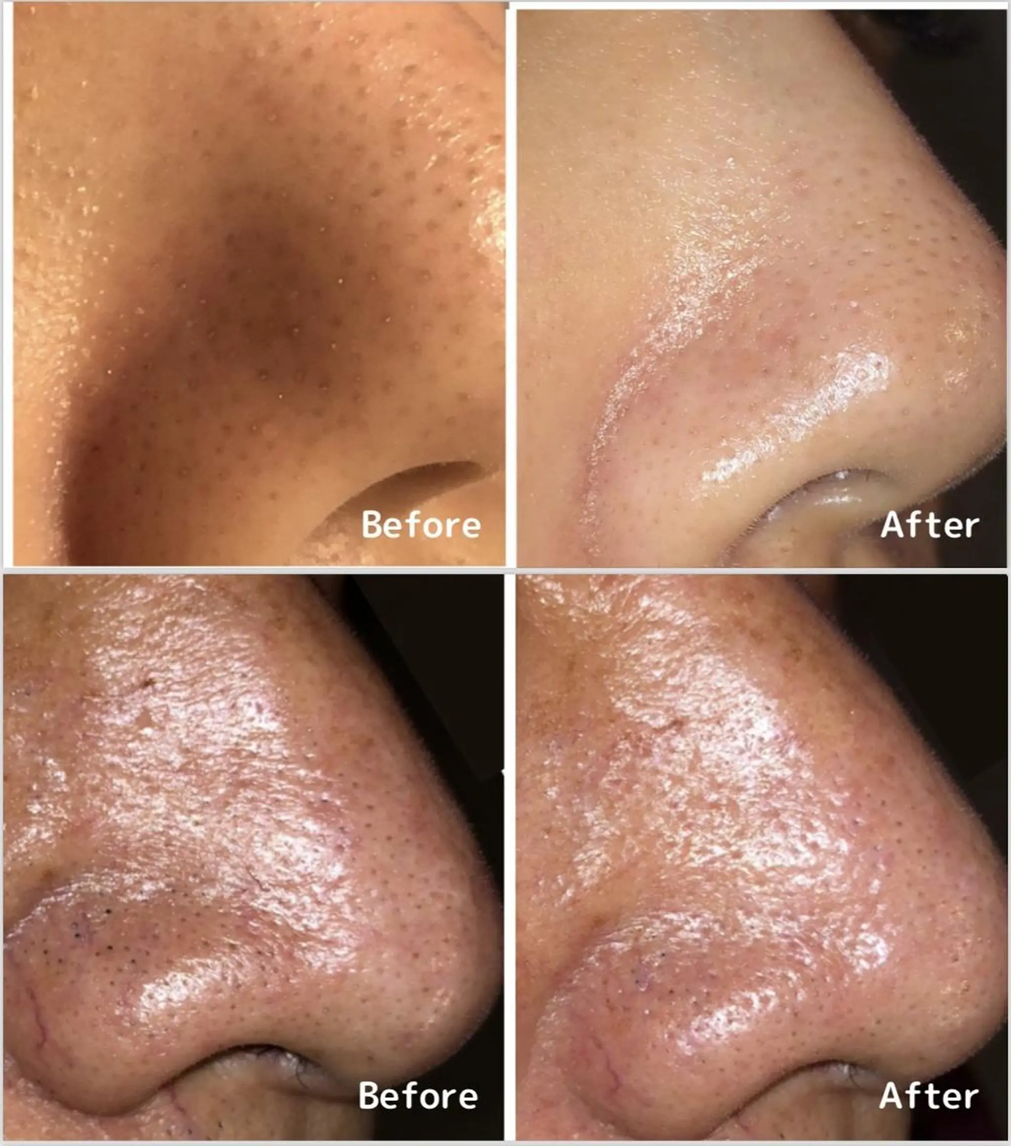 アンジェリック ビーナス Rinonのエステ・リラクイメージ