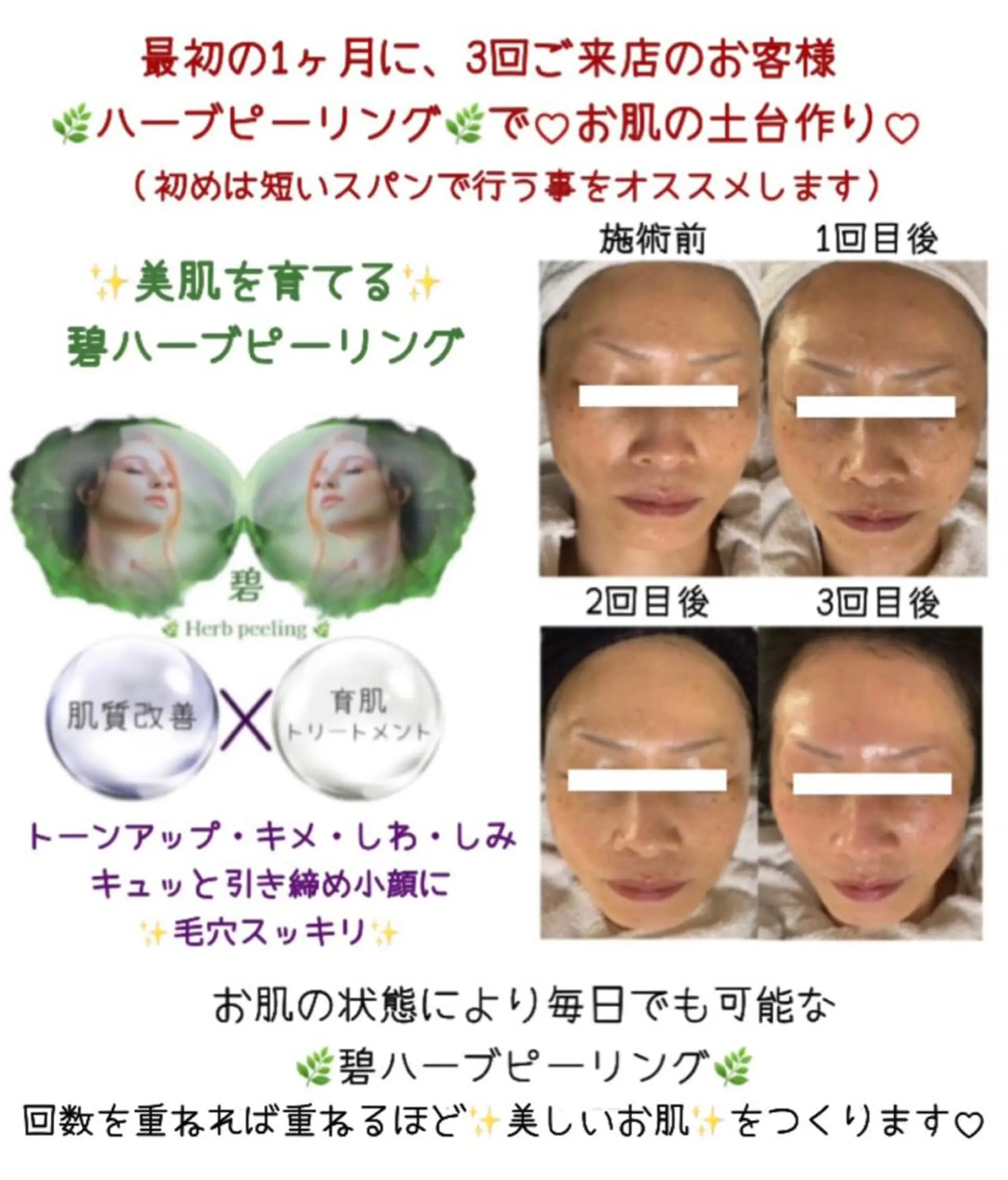 エステ ヴィーナス ビューティーのエステ・リラクイメージ