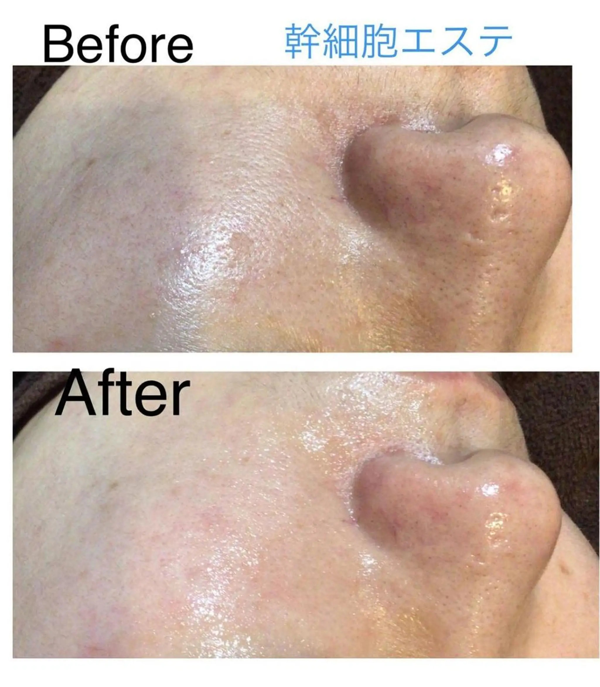 エステ リラク エヴァーグレース 河原町店のエステ・リラクイメージ