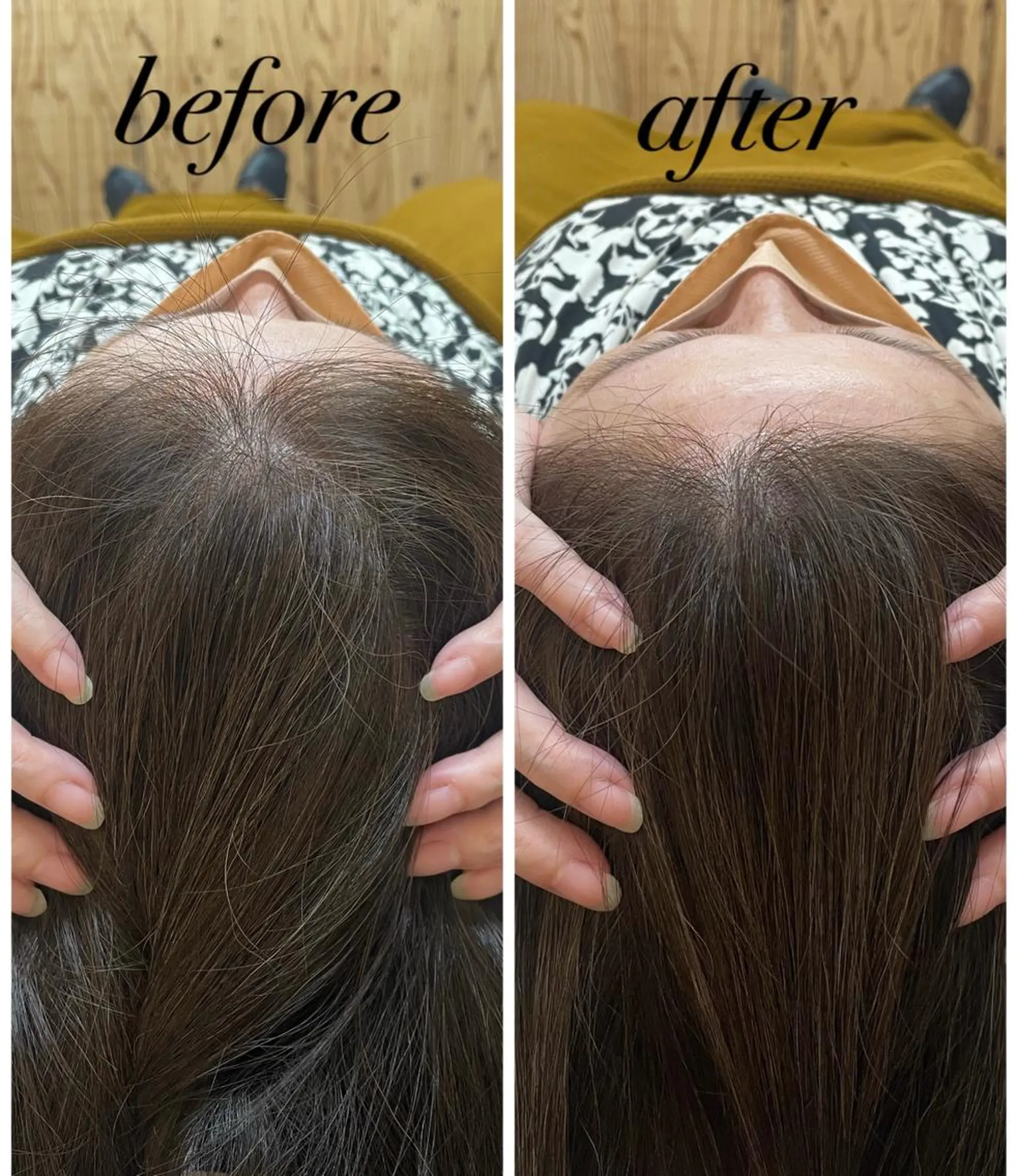 リラク ate'所属・個室ドライヘッドスパ 🍃moriのエステ・リラクイメージ