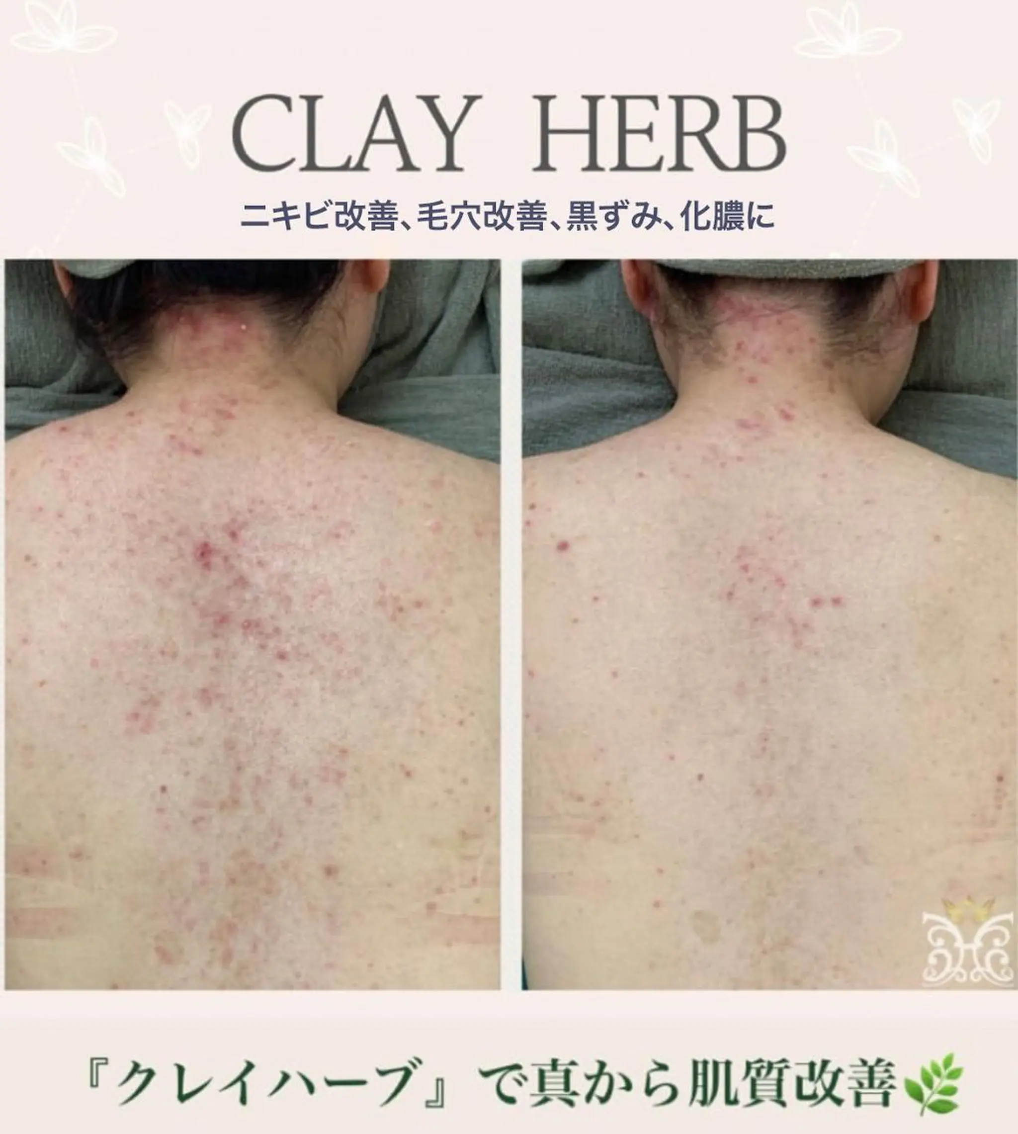 美肌&アロマ🌸 nana 中目黒のエステ・リラクイメージ