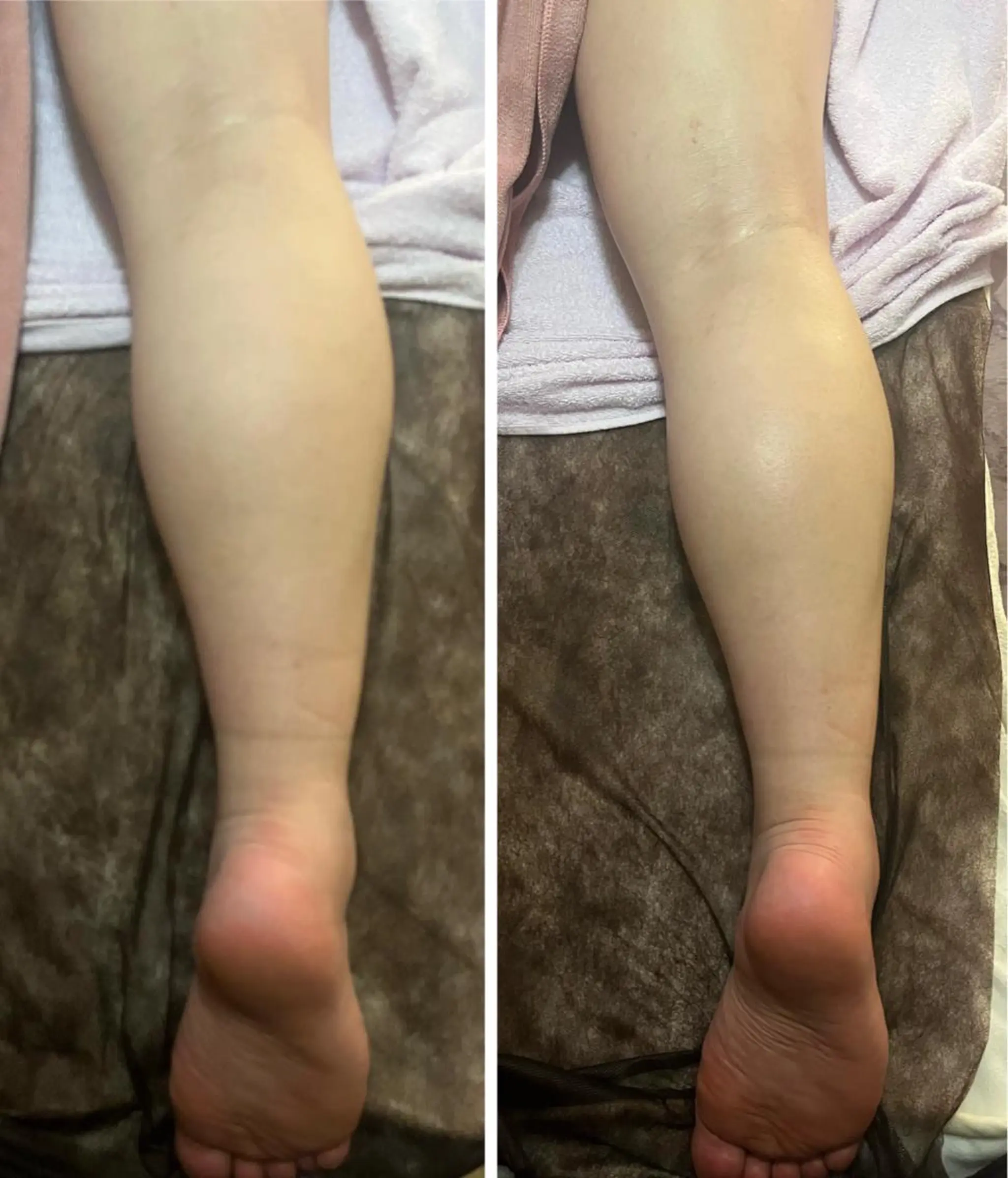 アロマ･美容鍼･カッ ピング「麗」鍼灸院のエステ・リラクイメージ