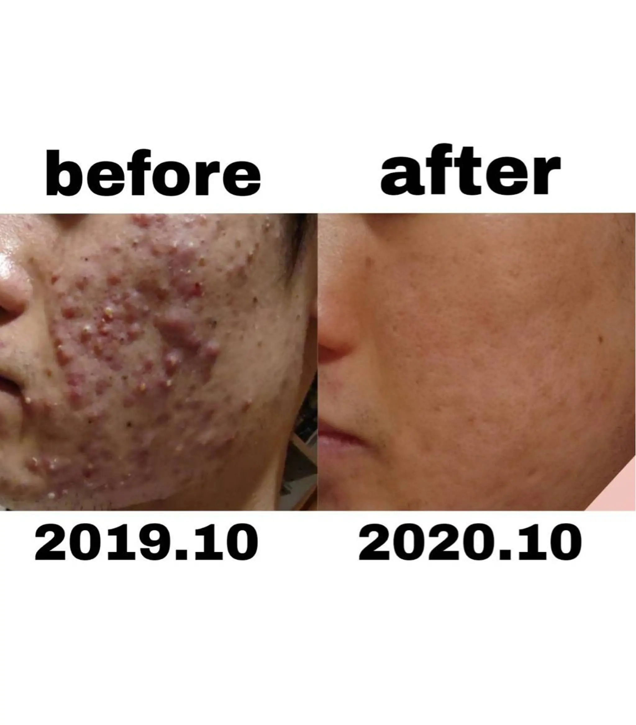 エステ 斉藤 絵梨のエステ・リラクイメージ