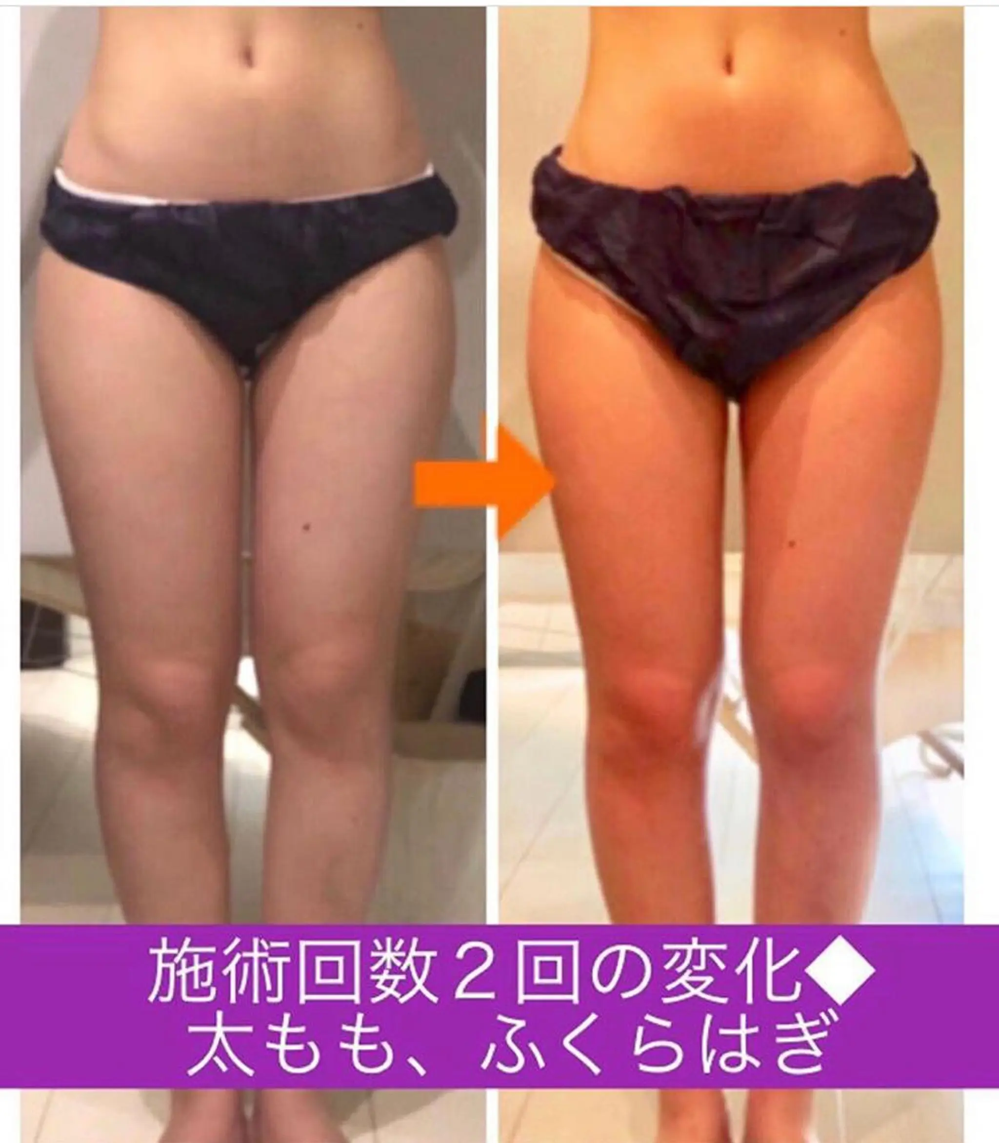 ロング カラー パーマ ヘアアレンジ メンズ キッズ ネイル マツエク・マツパ ‍痩身＆ボディ 結果出し🌟丹野のエステ・リラクイメージ