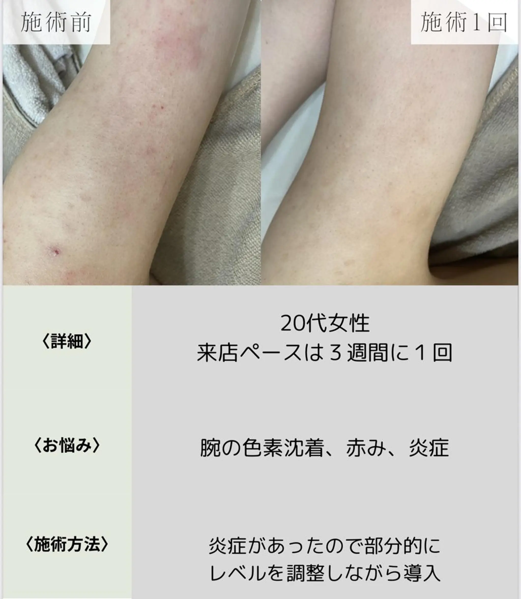 脱毛・眉毛・フェイス サロンN久留米店の眉毛・アイブロウイメージ