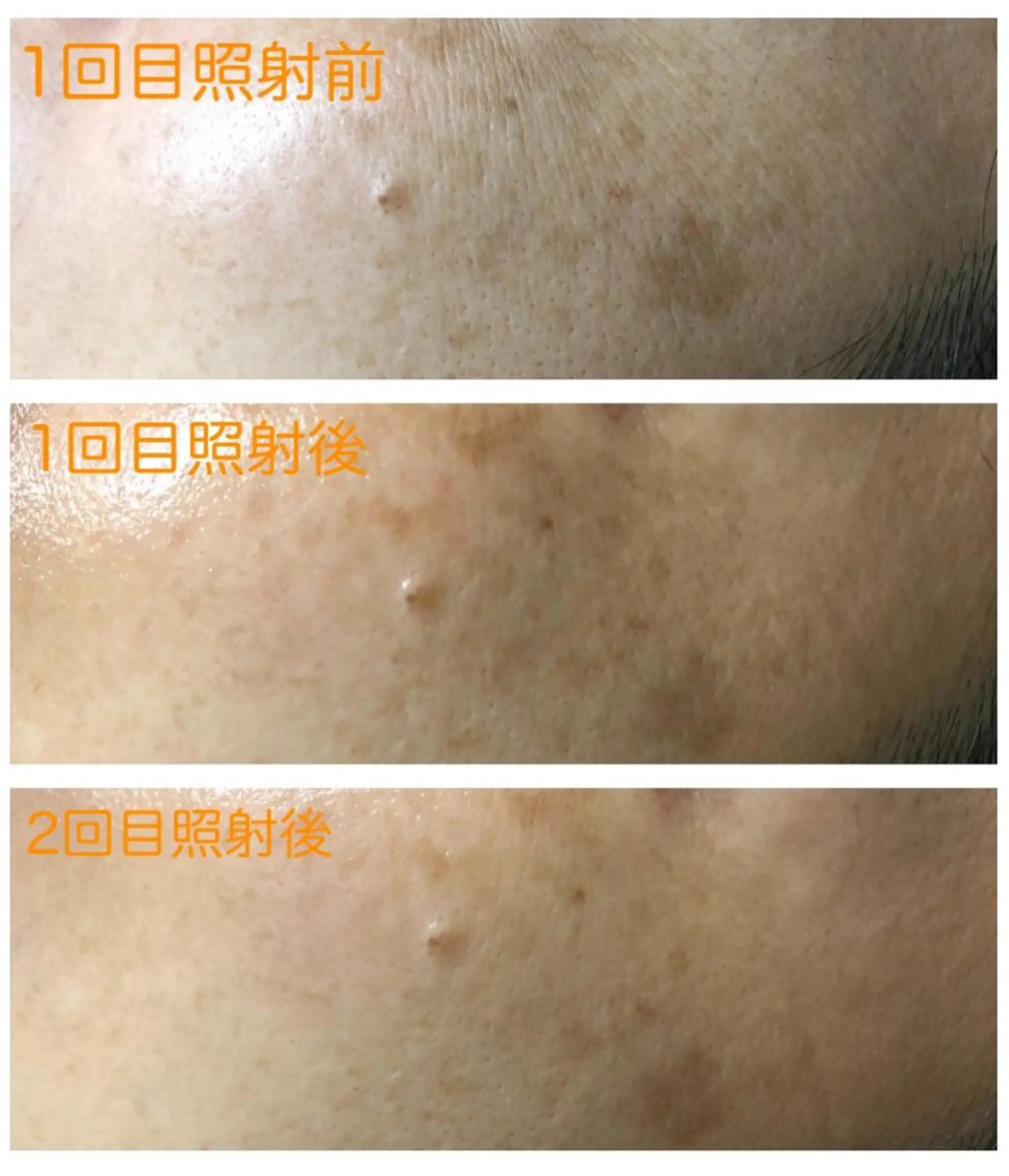 salon   de epilaのエステ・リラクイメージ