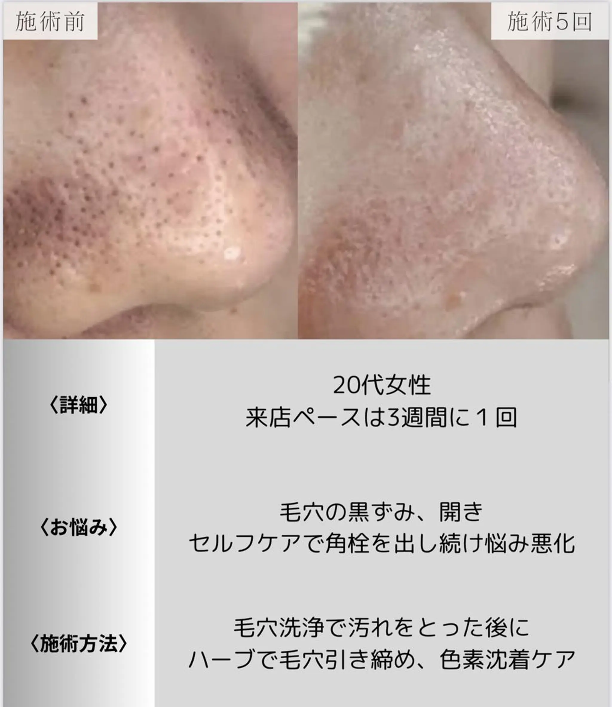 脱毛・眉毛・フェイス サロンN久留米店の眉毛・アイブロウイメージ