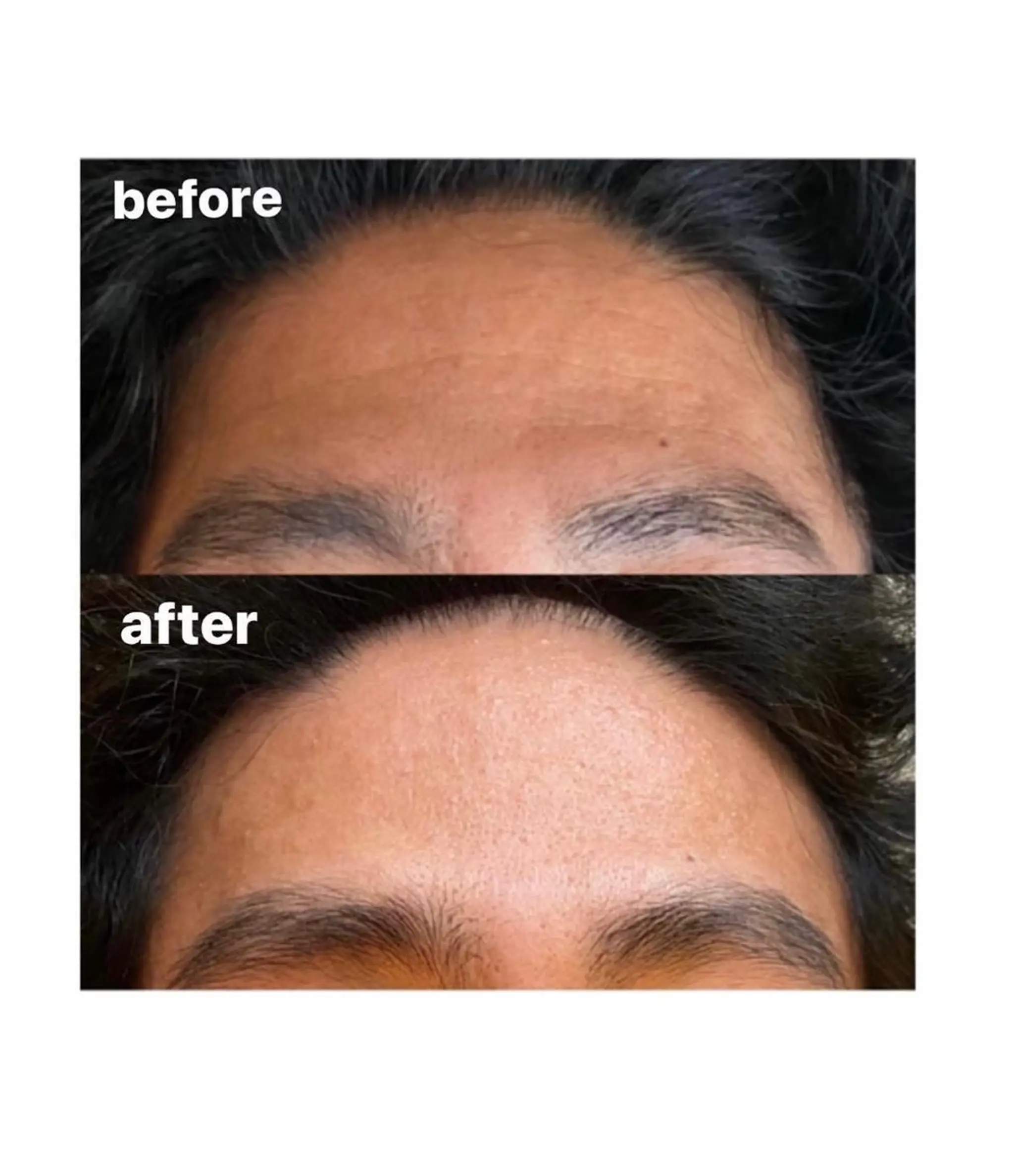 整形級の変化👀 最新✨韓国小顔管理のエステ・リラクイメージ