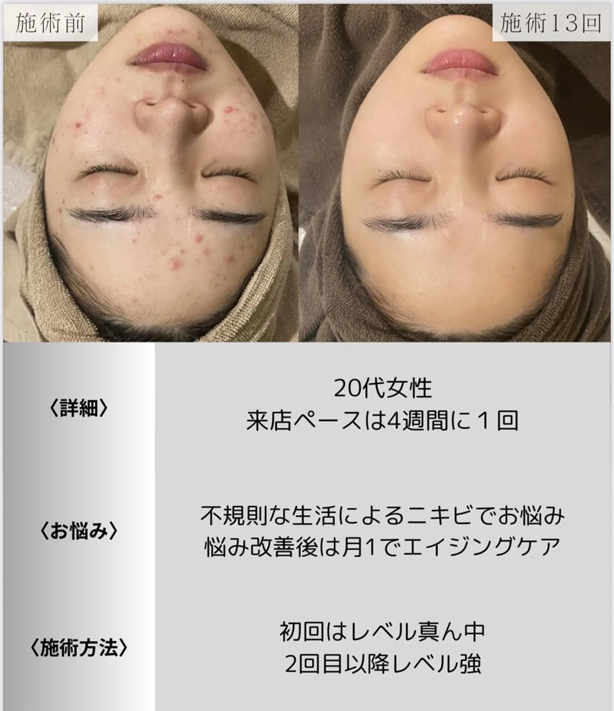 脱毛・眉毛・フェイス サロンN久留米店の眉毛・アイブロウイメージ