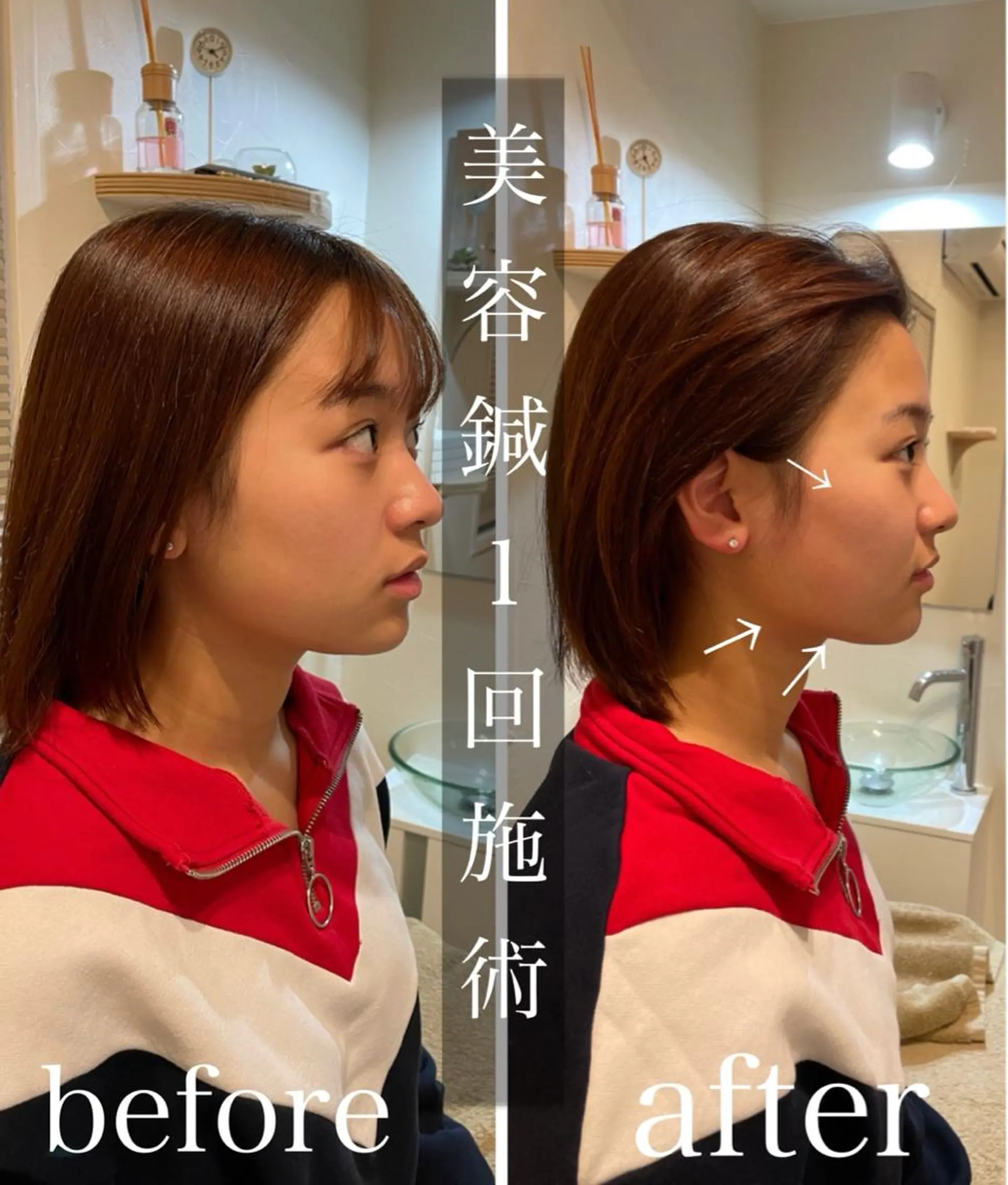 鍼灸 Refineのその他イメージ