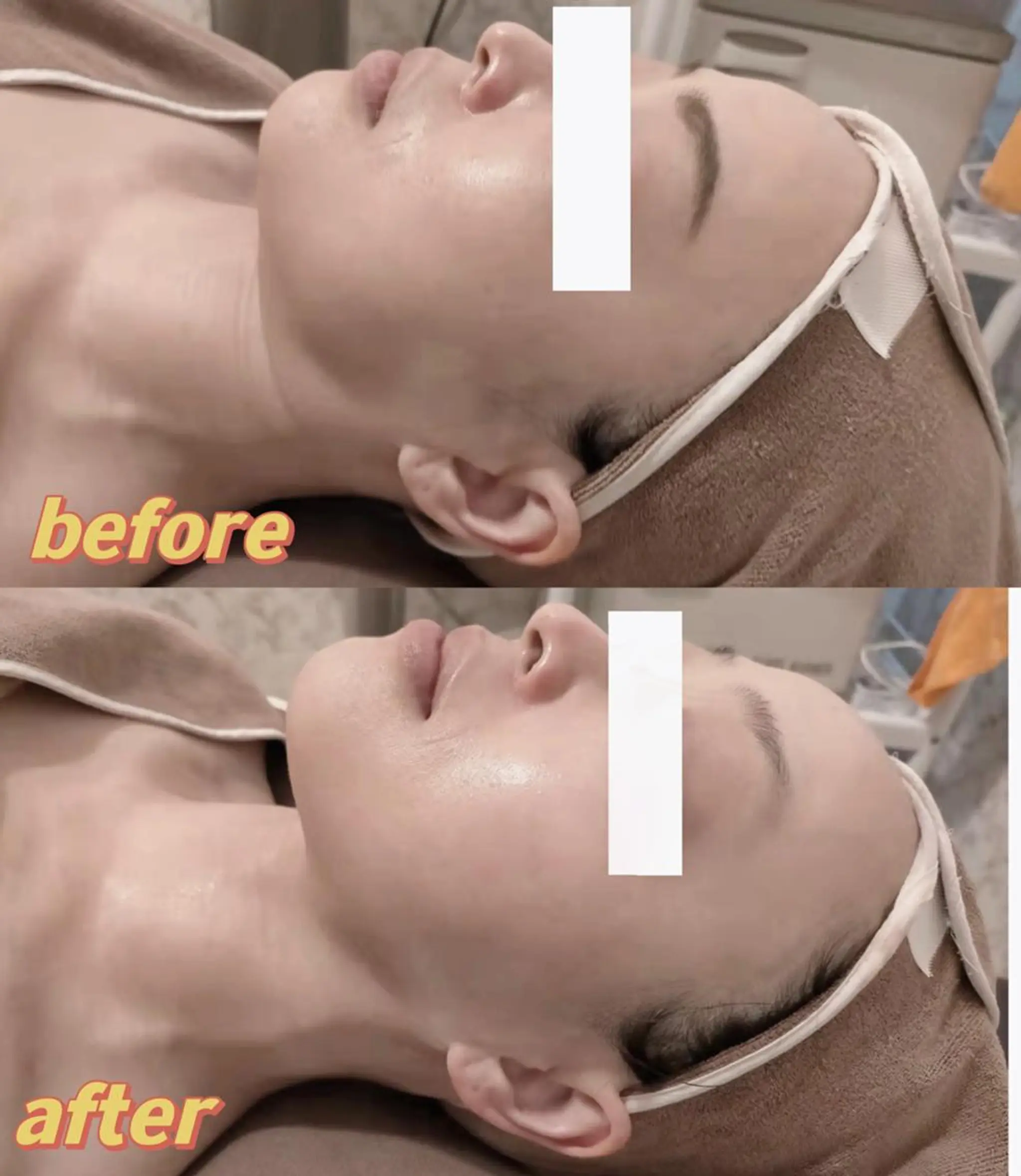 西区九条エステ MITUREIサロンのエステ・リラクイメージ