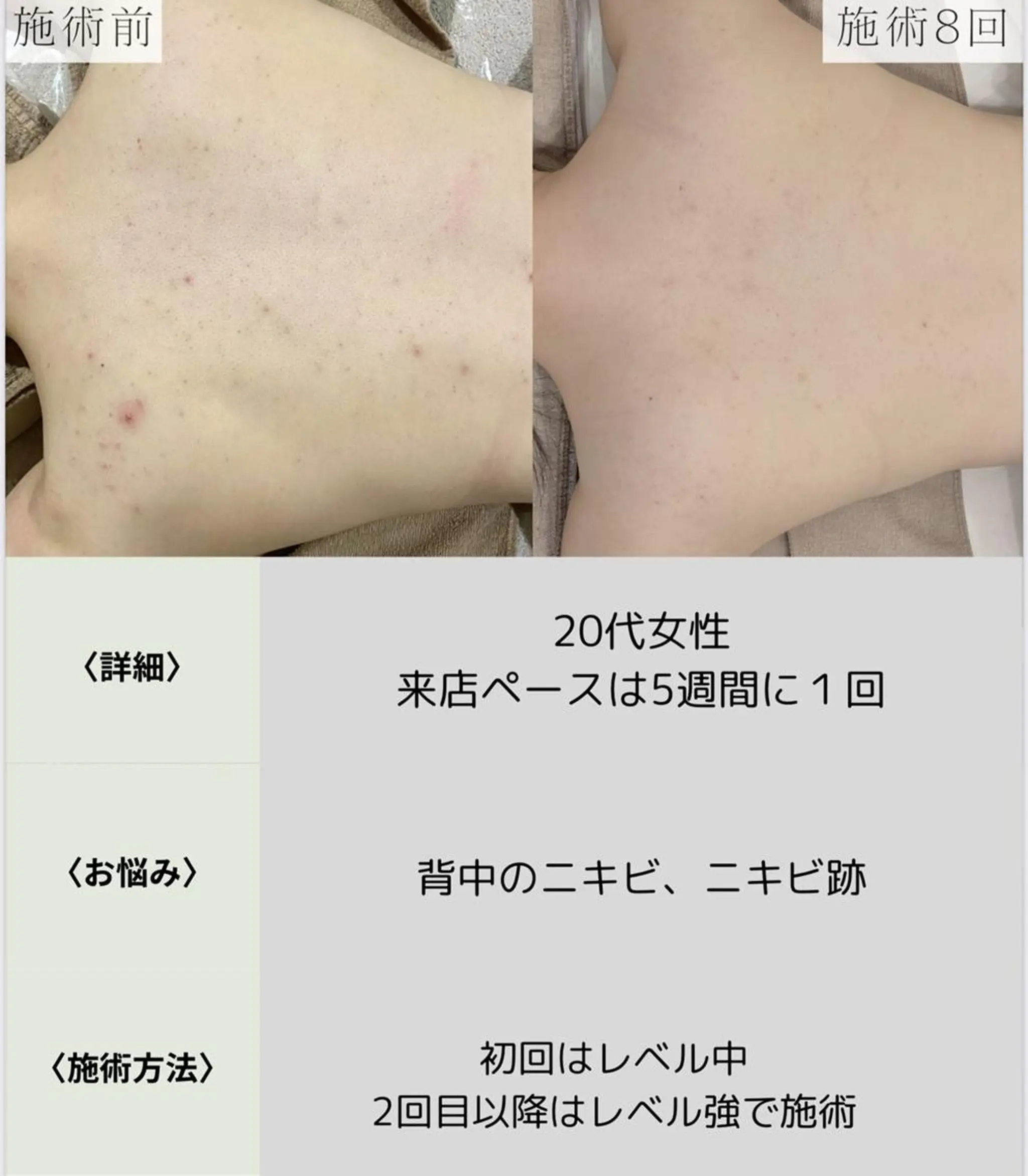 脱毛・眉毛・フェイス サロンN久留米店の眉毛・アイブロウイメージ