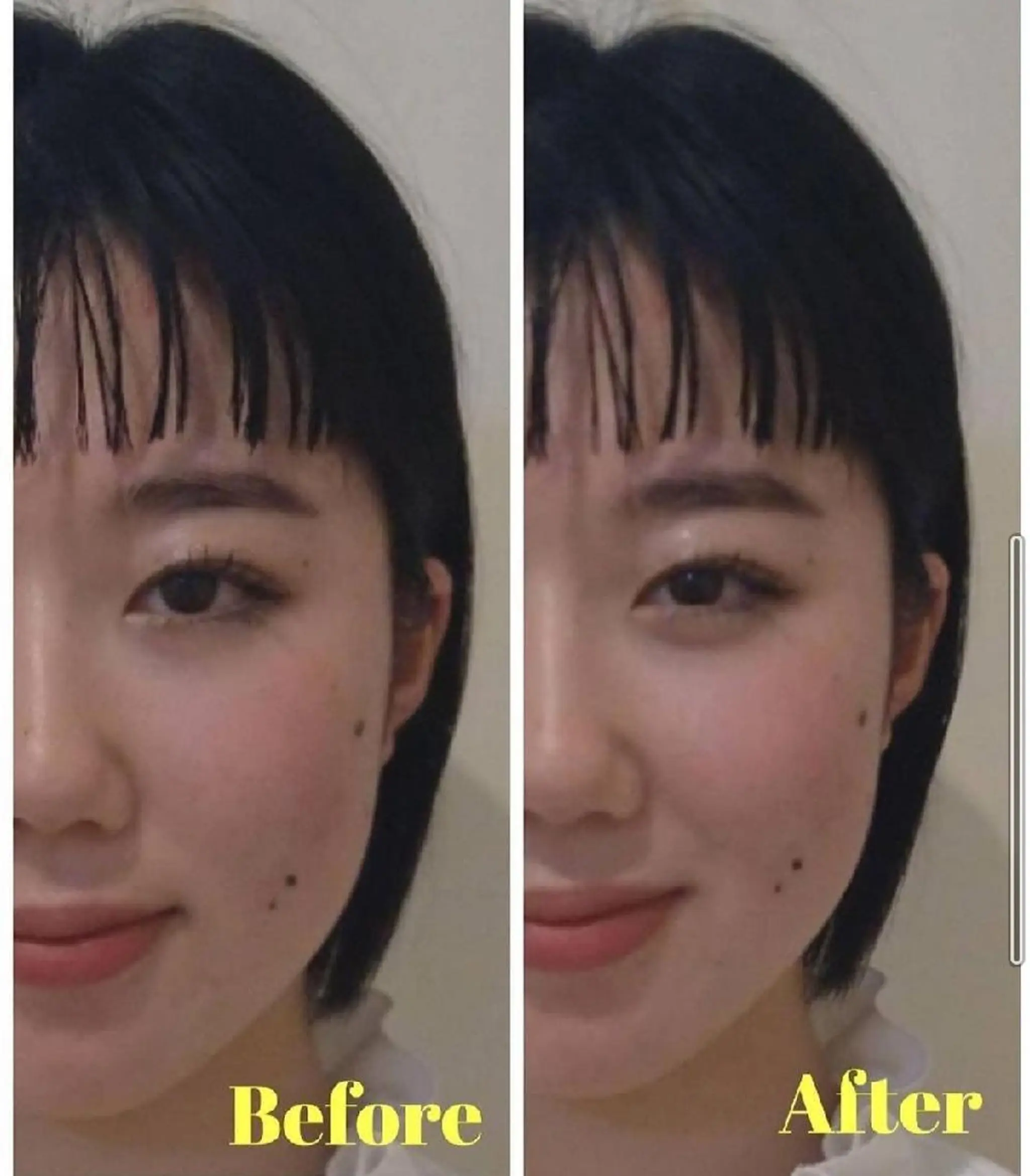 💙美容鍼💙美顔矯 正🧡Brilo🧡のエステ・リラクイメージ