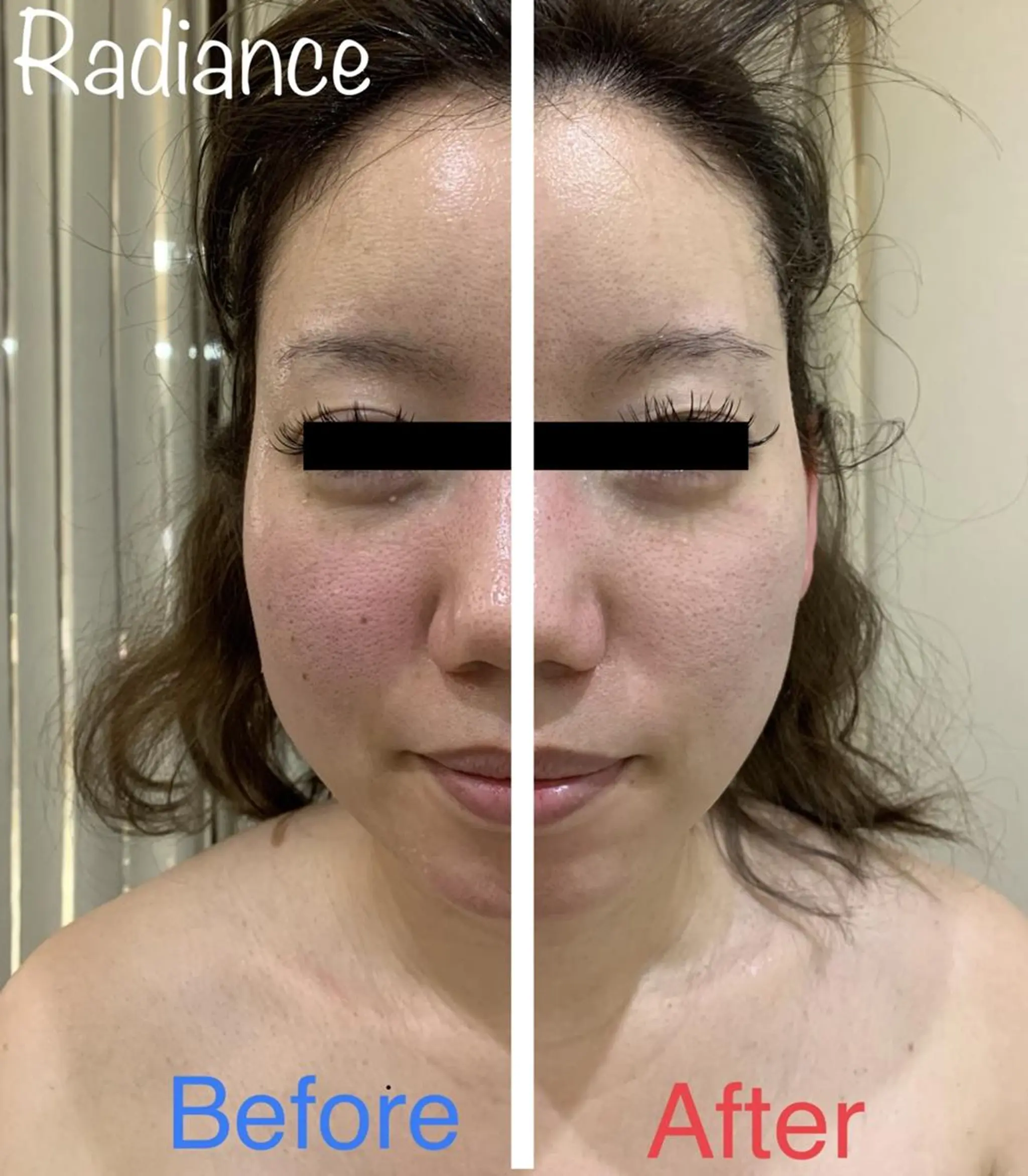 エステ 札幌ホワイトニング ラディアンス菊水店のその他イメージ