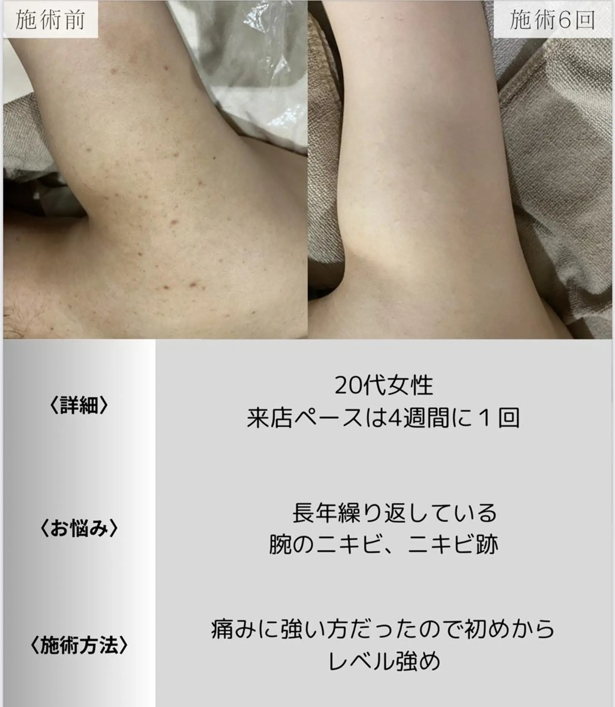 脱毛・眉毛・フェイス サロンN久留米店の眉毛・アイブロウイメージ