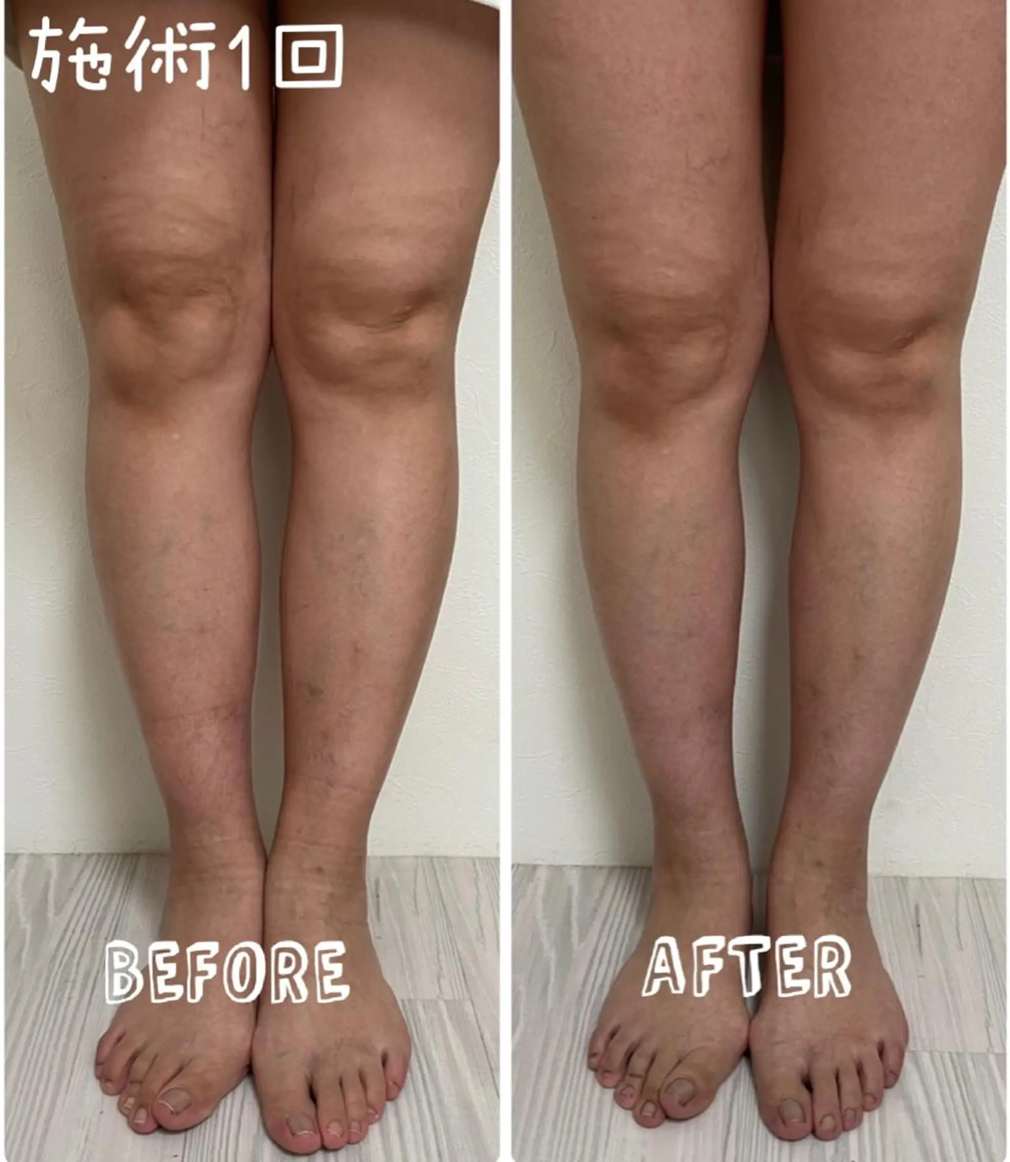 Yoshino Erinaのエステ・リラクイメージ